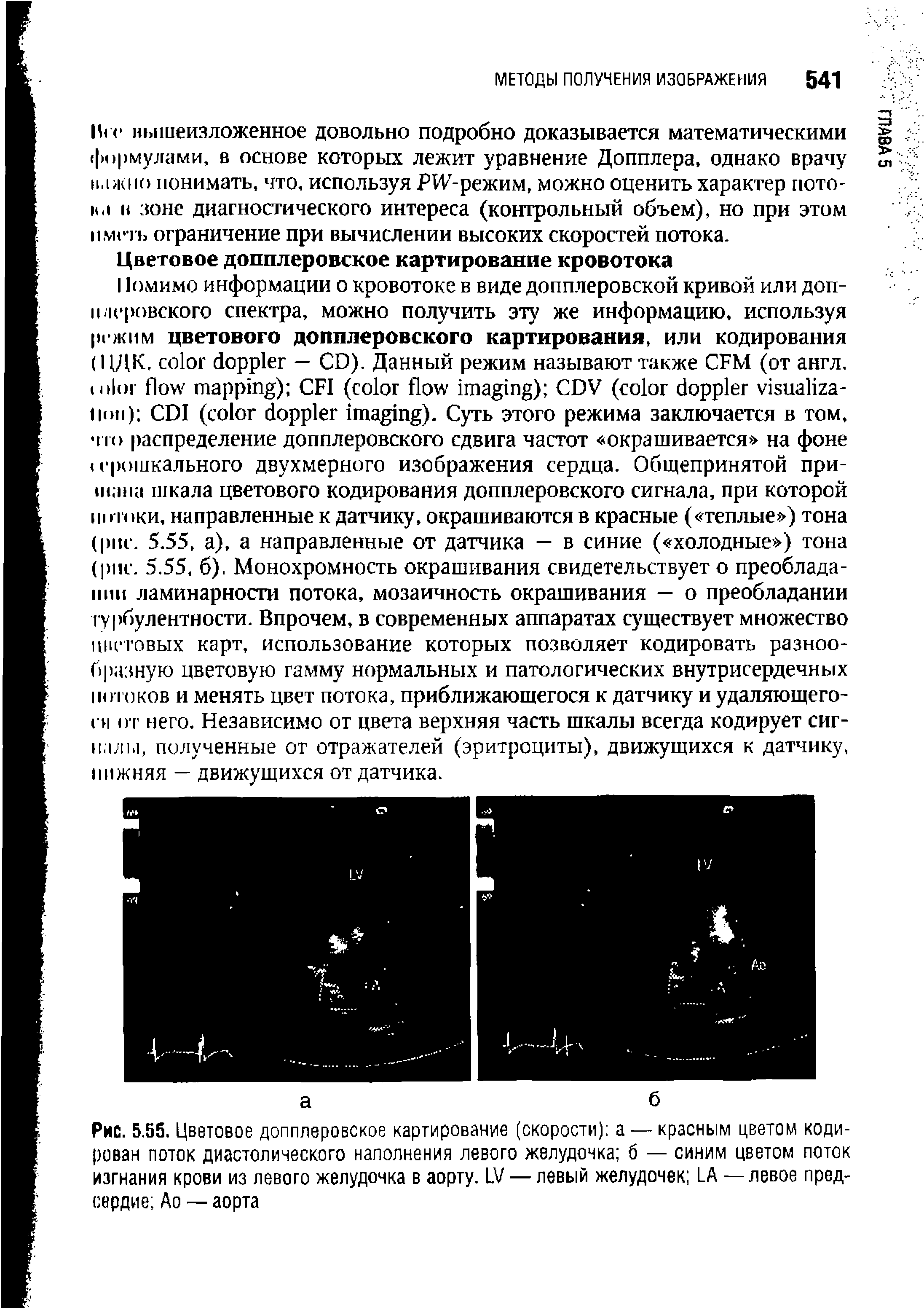 Рис. 5.55. Цветовое допплеровское картирование (скорости) а — красным цветом кодирован поток диастолического наполнения левого желудочка б — синим цветом поток изгнания крови из левого желудочка в аорту. 15/ — левый желудочек 1.А — левое предсердие Ао — аорта...