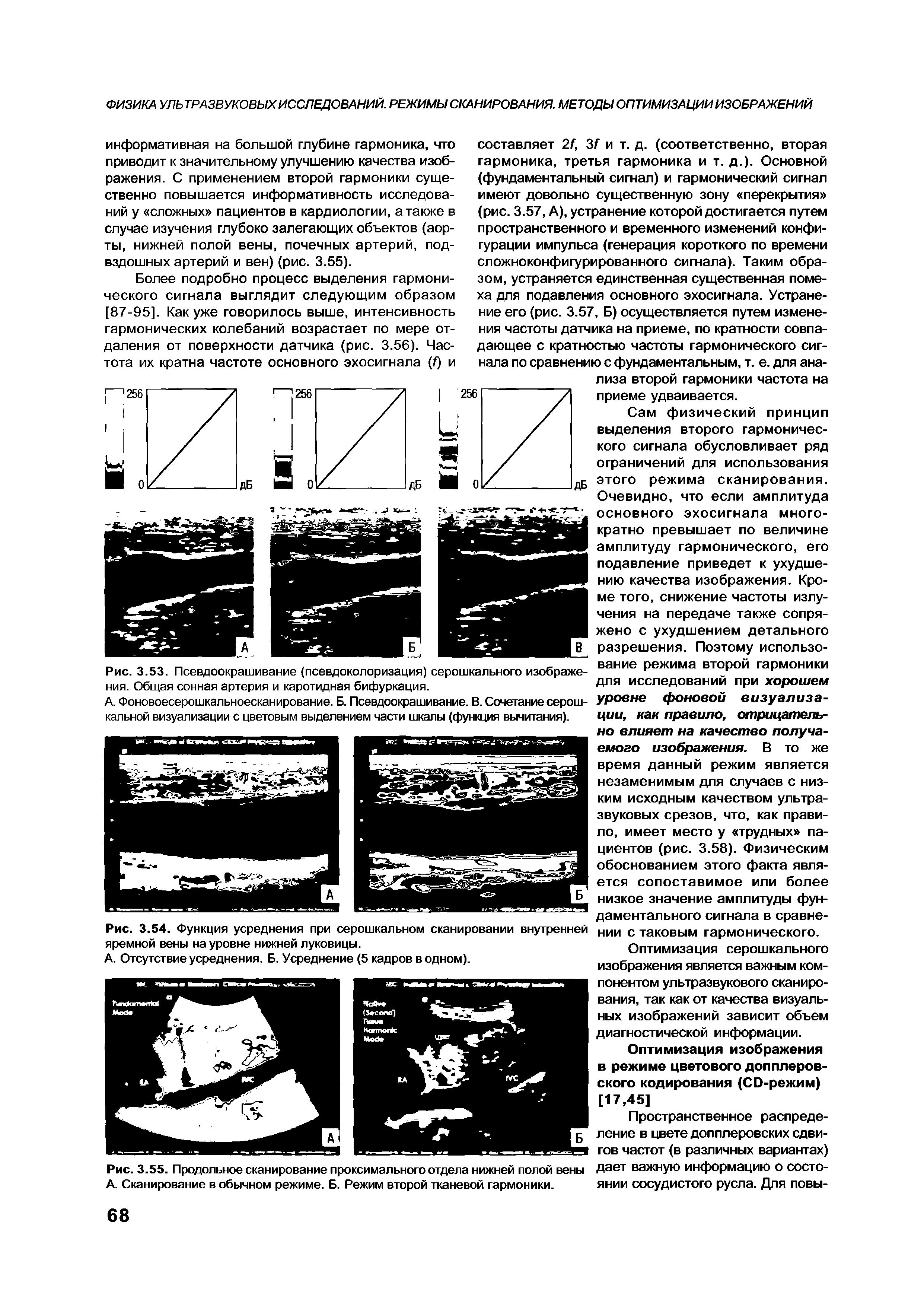 Рис. 3.54. Функция усреднения при серошкальном сканировании внутренней яремной вены на уровне нижней луковицы.