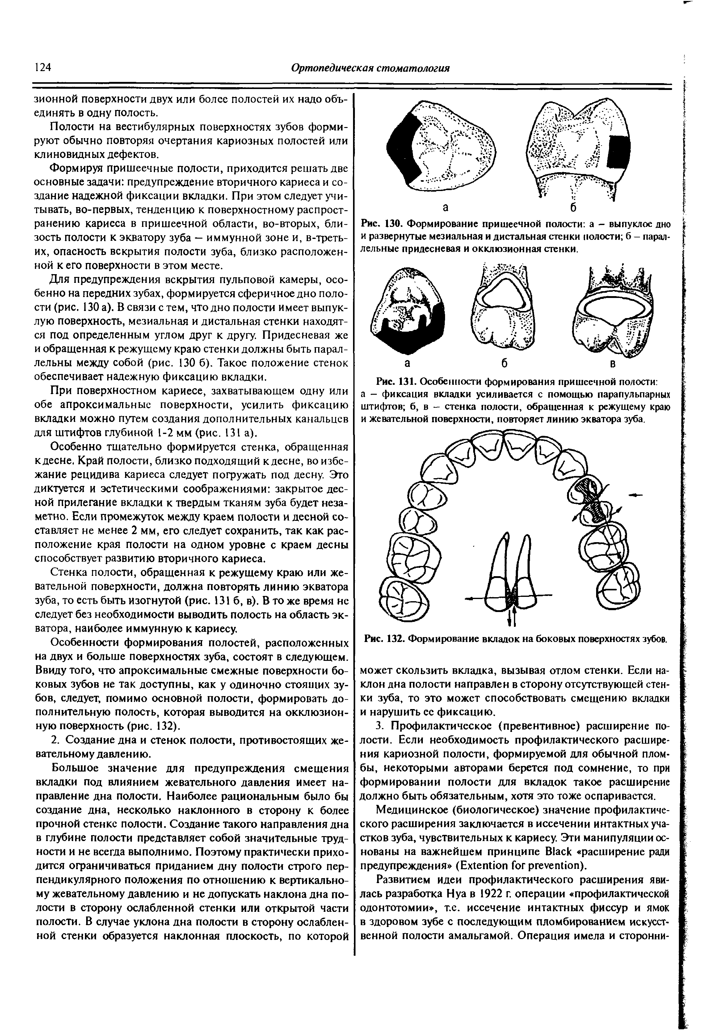 Рис. 131. Особенности формирования пришеечной полости а - фиксация вкладки усиливается с помощью парапульпарных штифтов б, в — стенка полости, обращенная к режущему краю и жевательной поверхности, повторяет линию экватора зуба.