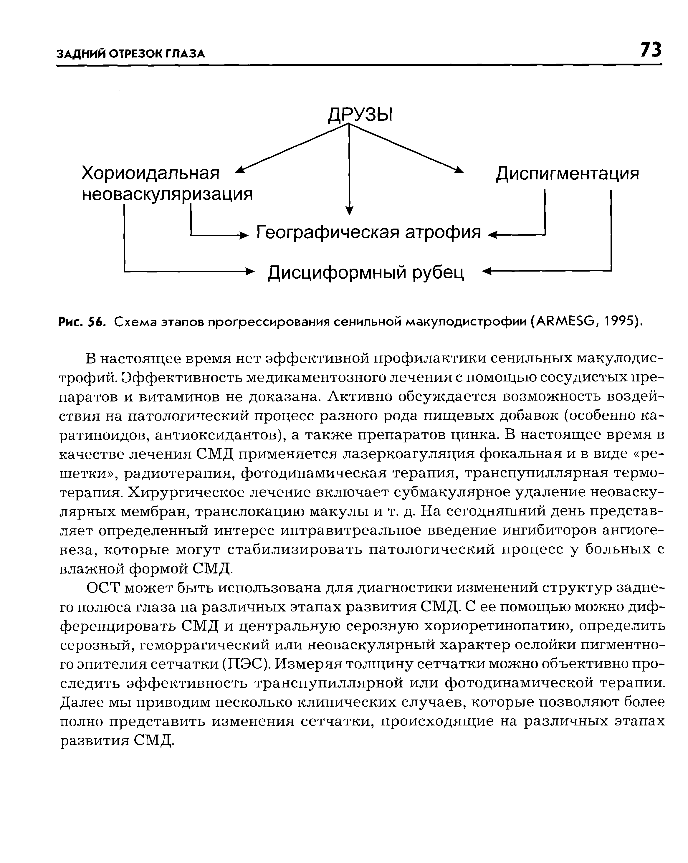 Рис. 56. Схема этапов прогрессирования сенильной макулодистрофии (А1 МЕ5С, 1995).