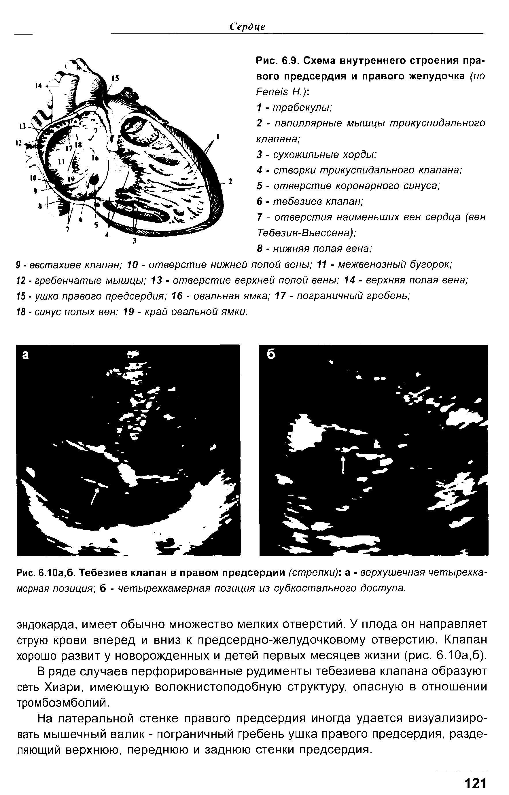 Рис. 6.9. Схема внутреннего строения правого предсердия и правого желудочка (по...