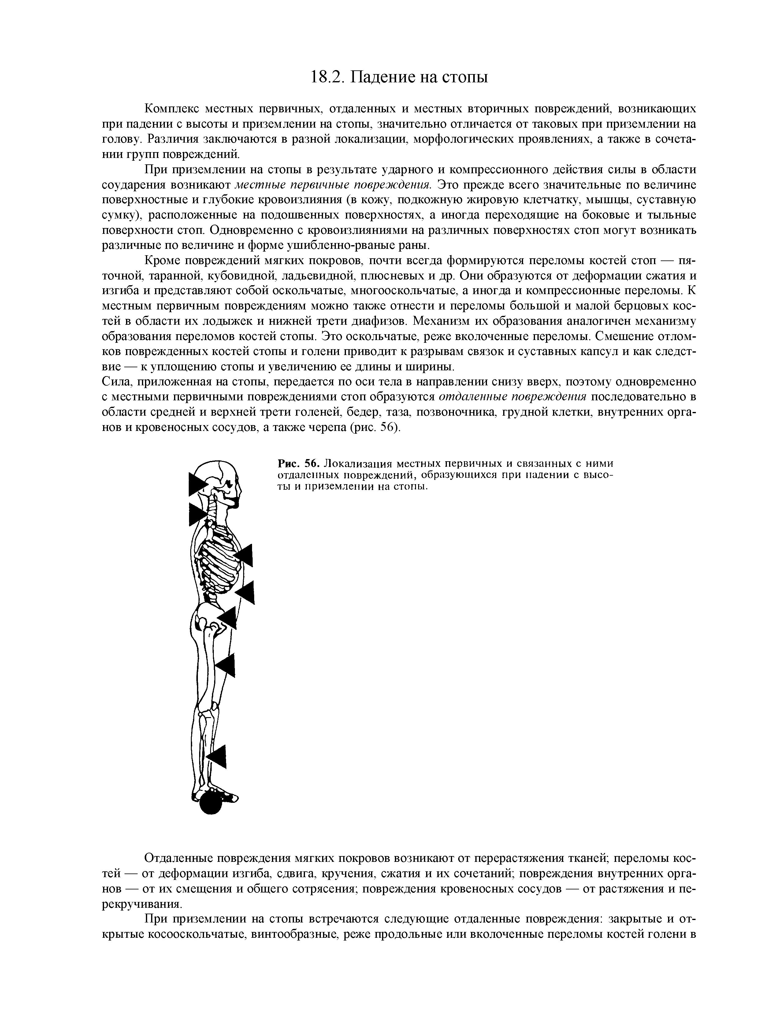 Рис. 56. Локализация местных первичных и связанных с ними отдаленных повреждений, образующихся при падении с высоты и приземлении на стопы.