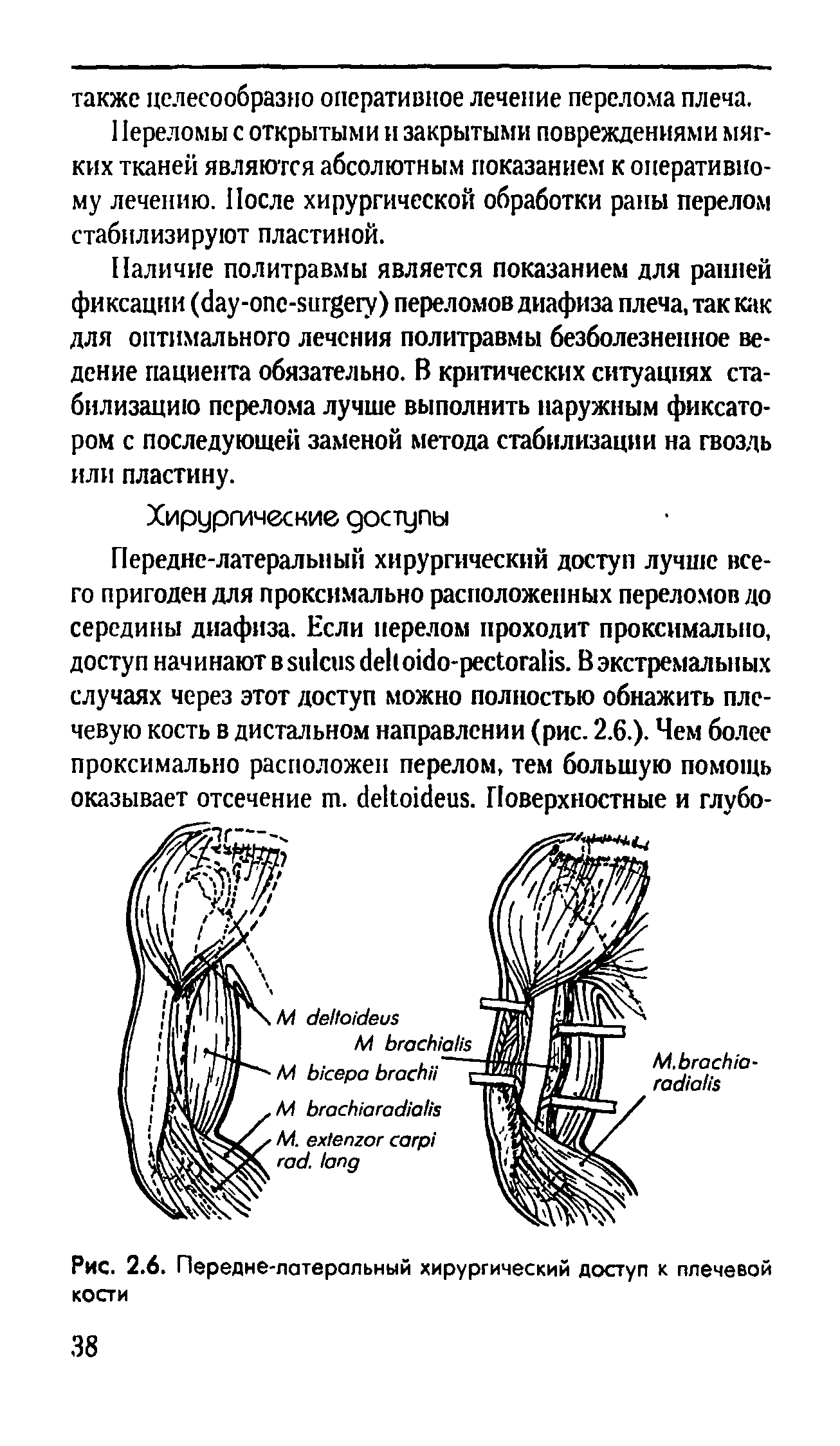 Рис. 2.6. Передне-латеральный хирургический доступ к плечевой кости...