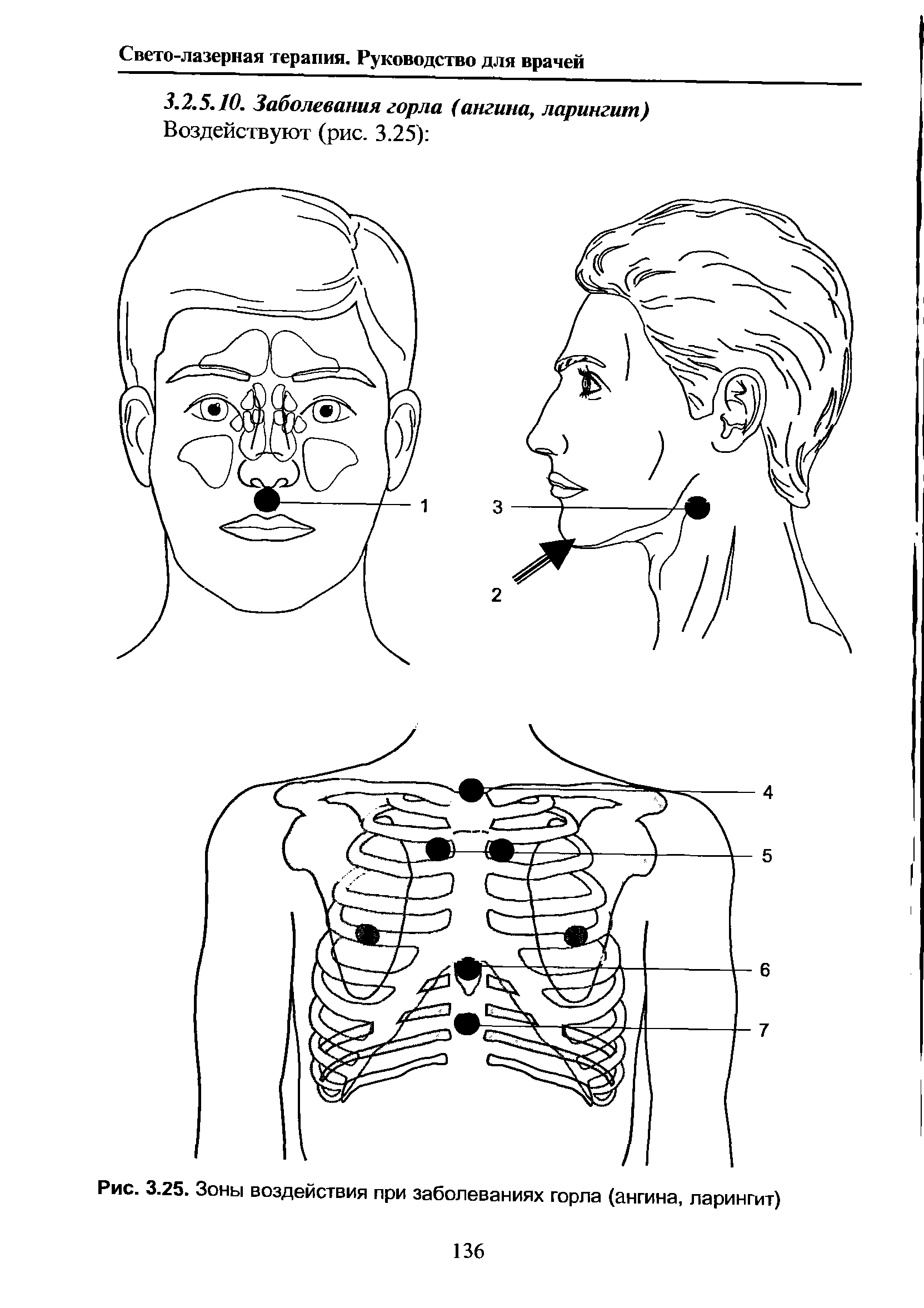 Рис. 3.25. Зоны воздействия при заболеваниях горла (ангина, ларингит)...