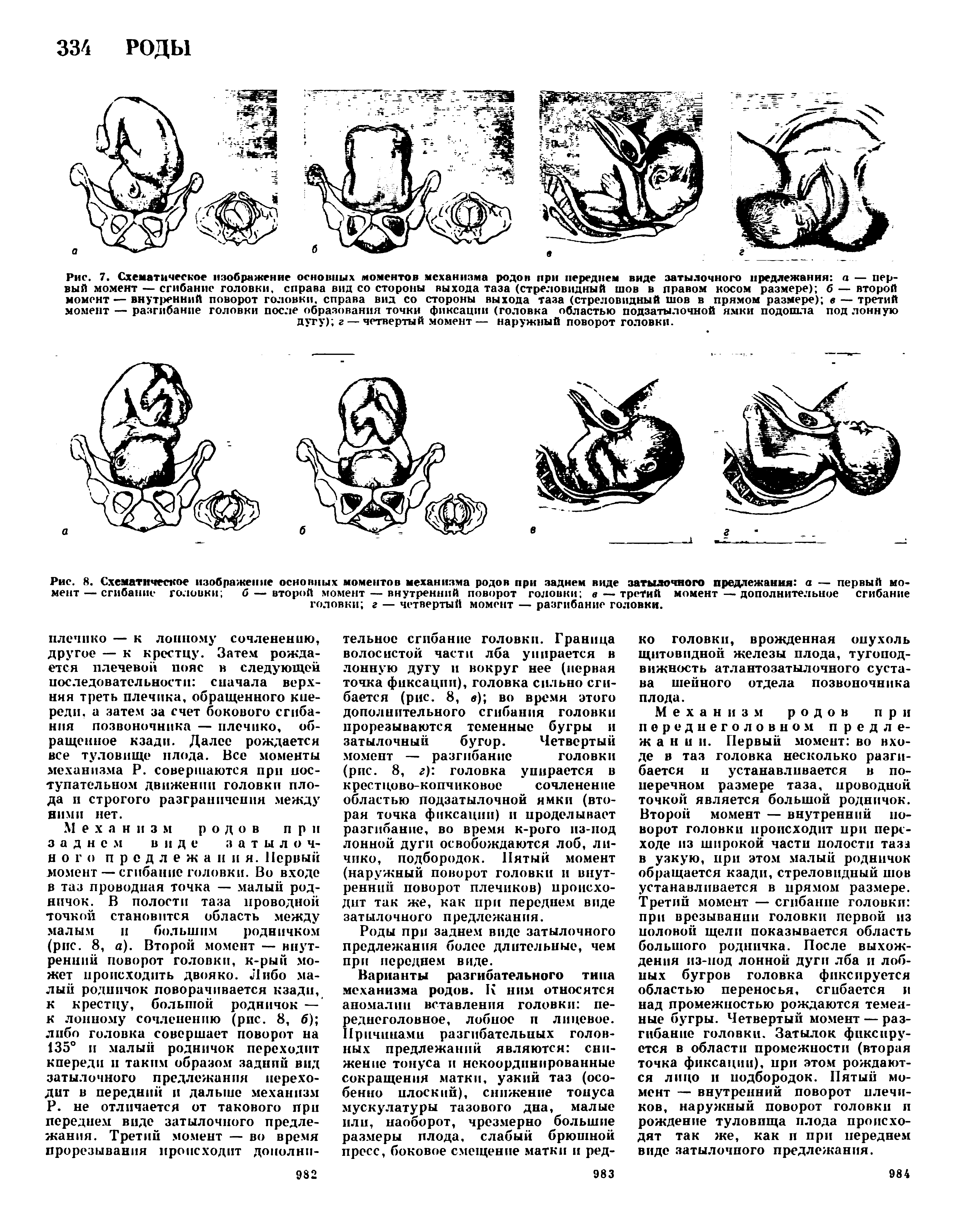 Рис. 8. Схематическое изображение основных моментов механизма родов при заднем виде затылочного предлежания а — первый момент — сгибание головки б — второй момент — внутренний поворот головки в — третий момент — дополнительное сгибание головки г — четвертый момент — разгибание головки.
