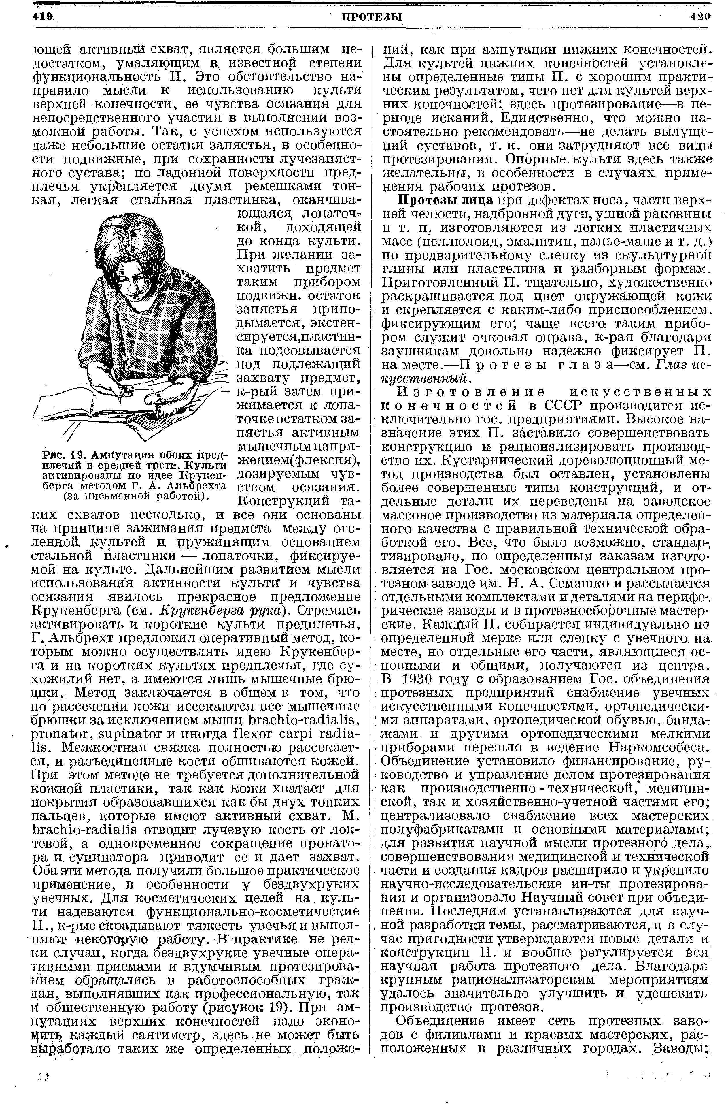 Рис. 19. Ампутация обоих предплечий в средней трети. Культи активированы по идее Крукенберга методом Г. А. Альбрехта (за письменной работой).