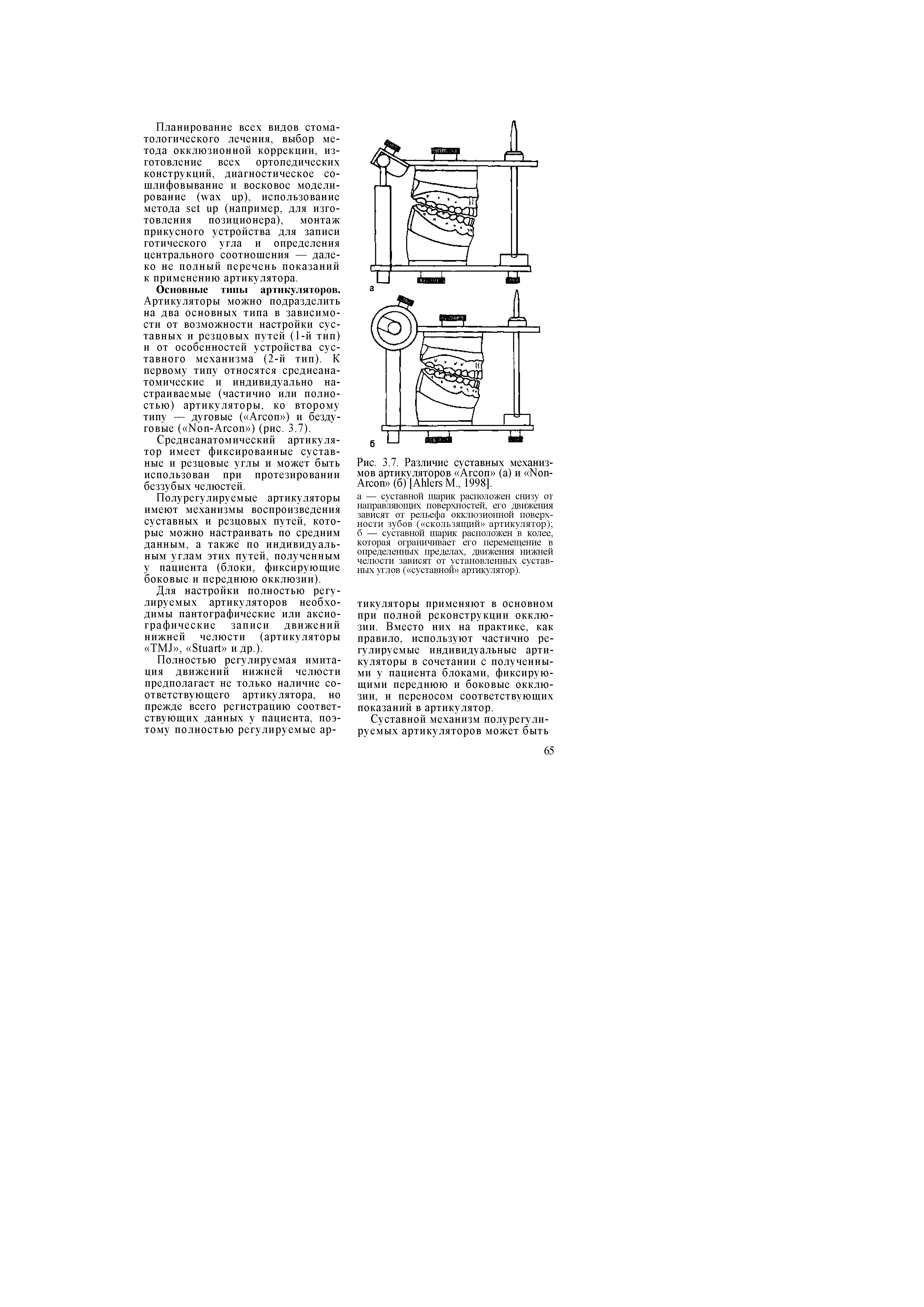 Рис. 3.7. Различие суставных механизмов артикуляторов Агсоп (а) и N -Агсоп (б) [A М., 1998].