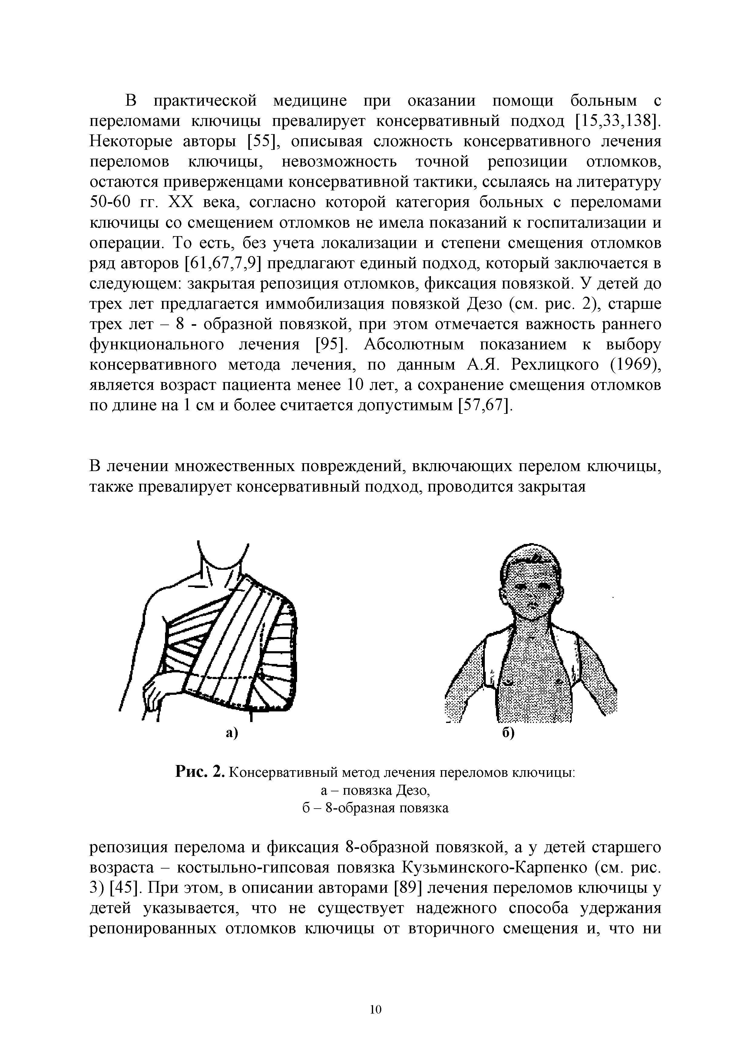 Рис. 2. Консервативный метод лечения переломов ключицы а - повязка Дезо, б - 8-образная повязка...