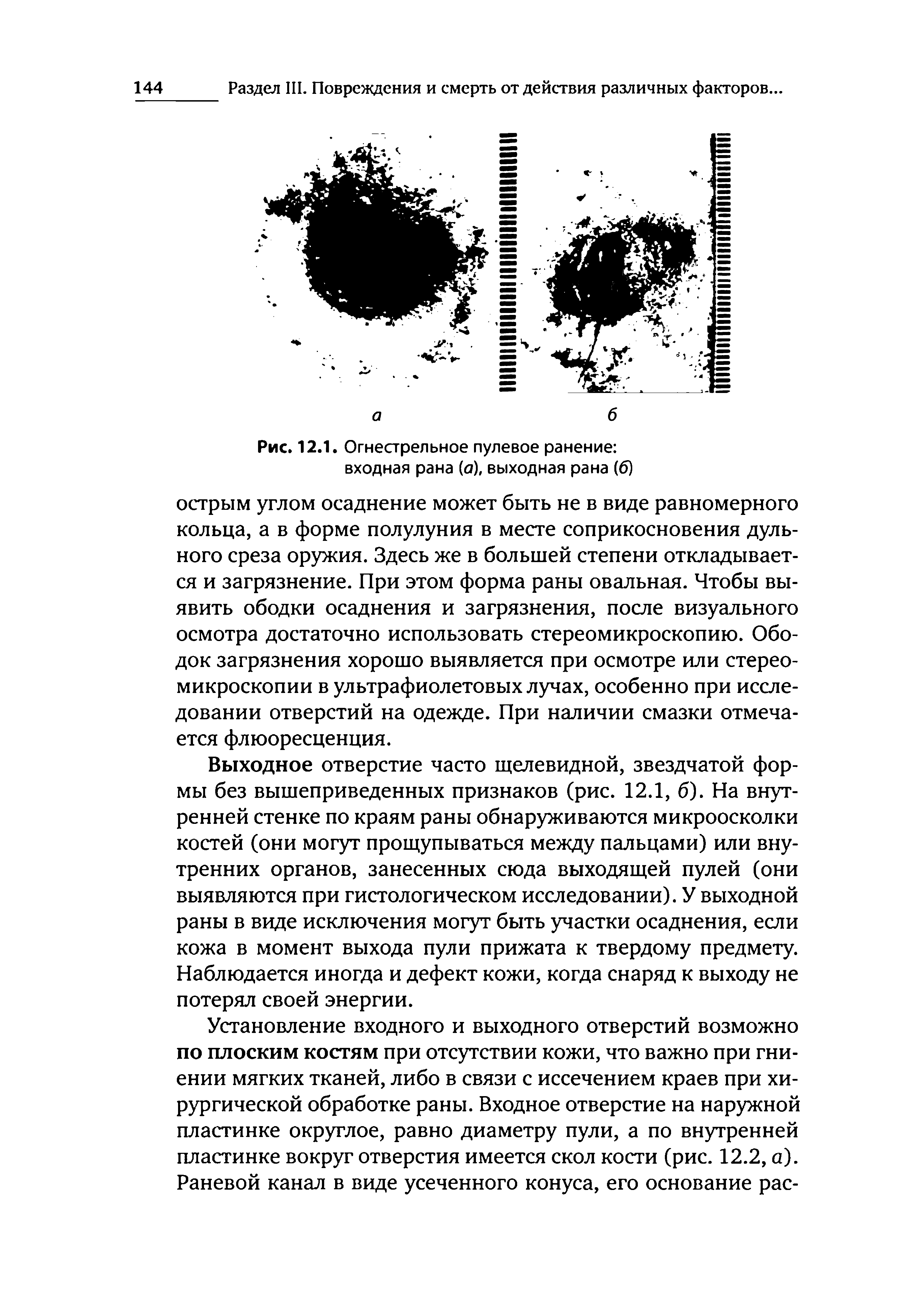 Рис. 12.1. Огнестрельное пулевое ранение входная рана (а), выходная рана (6)...