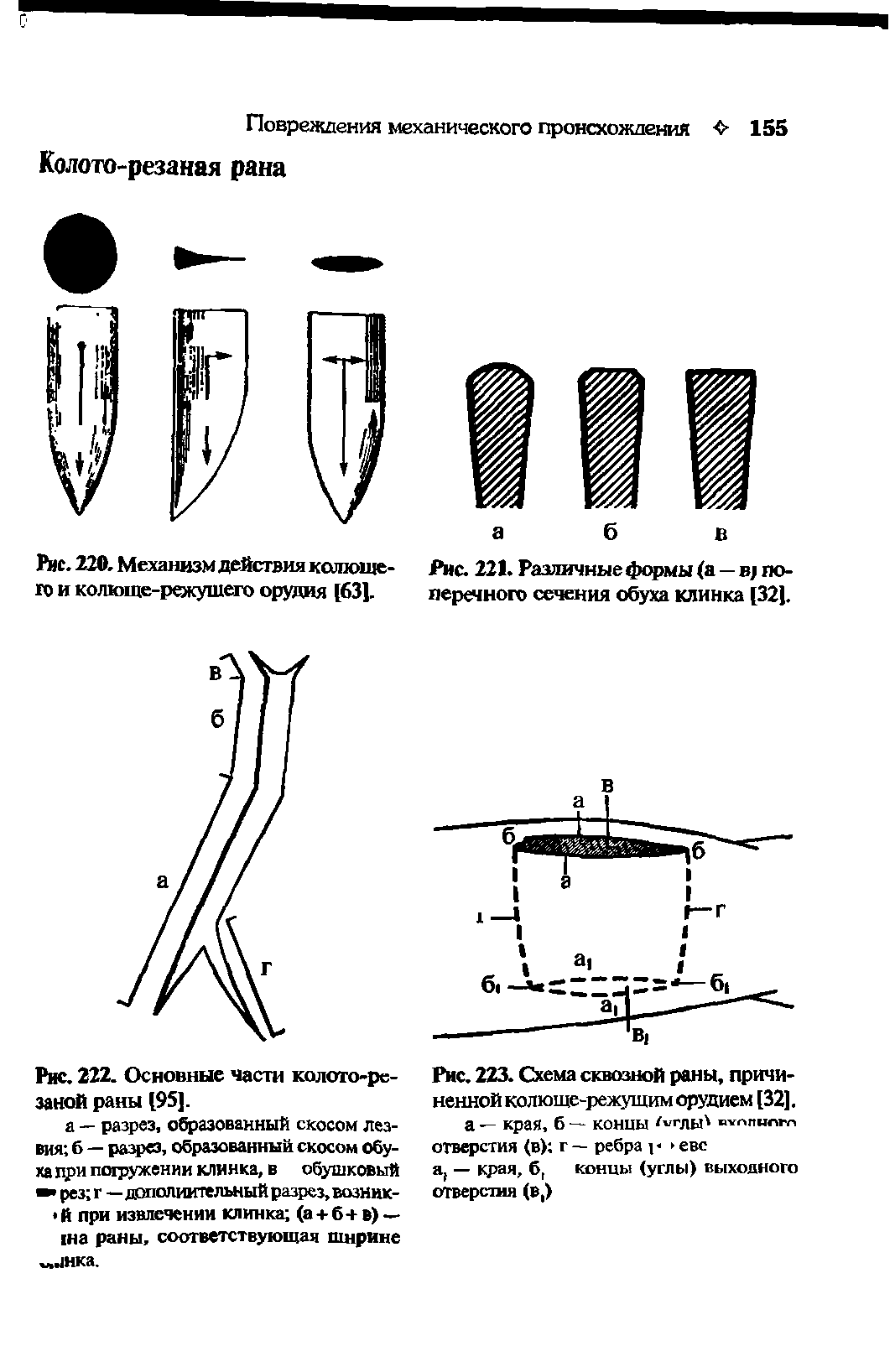 Рис. 223. Схема сквозной раны, причиненной колюще-режущим орудием [32].