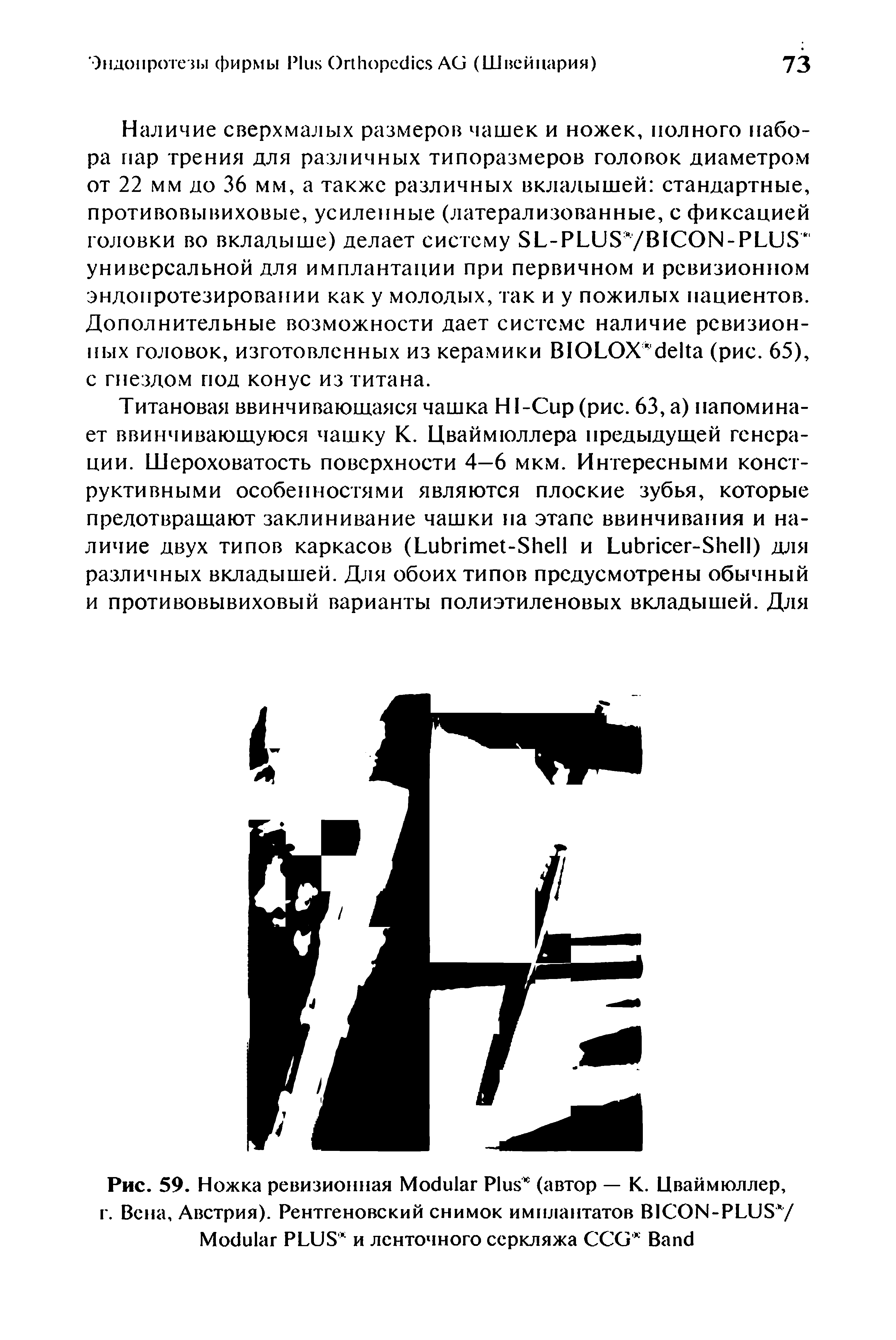 Рис. 59. Ножка ревизионная M P (автор — К. Цваймюллер, г. Вена, Австрия). Рентгеновский снимок имплантатов BICON-PLUS / M PLUS и ленточного ссркляжа CCG B ...