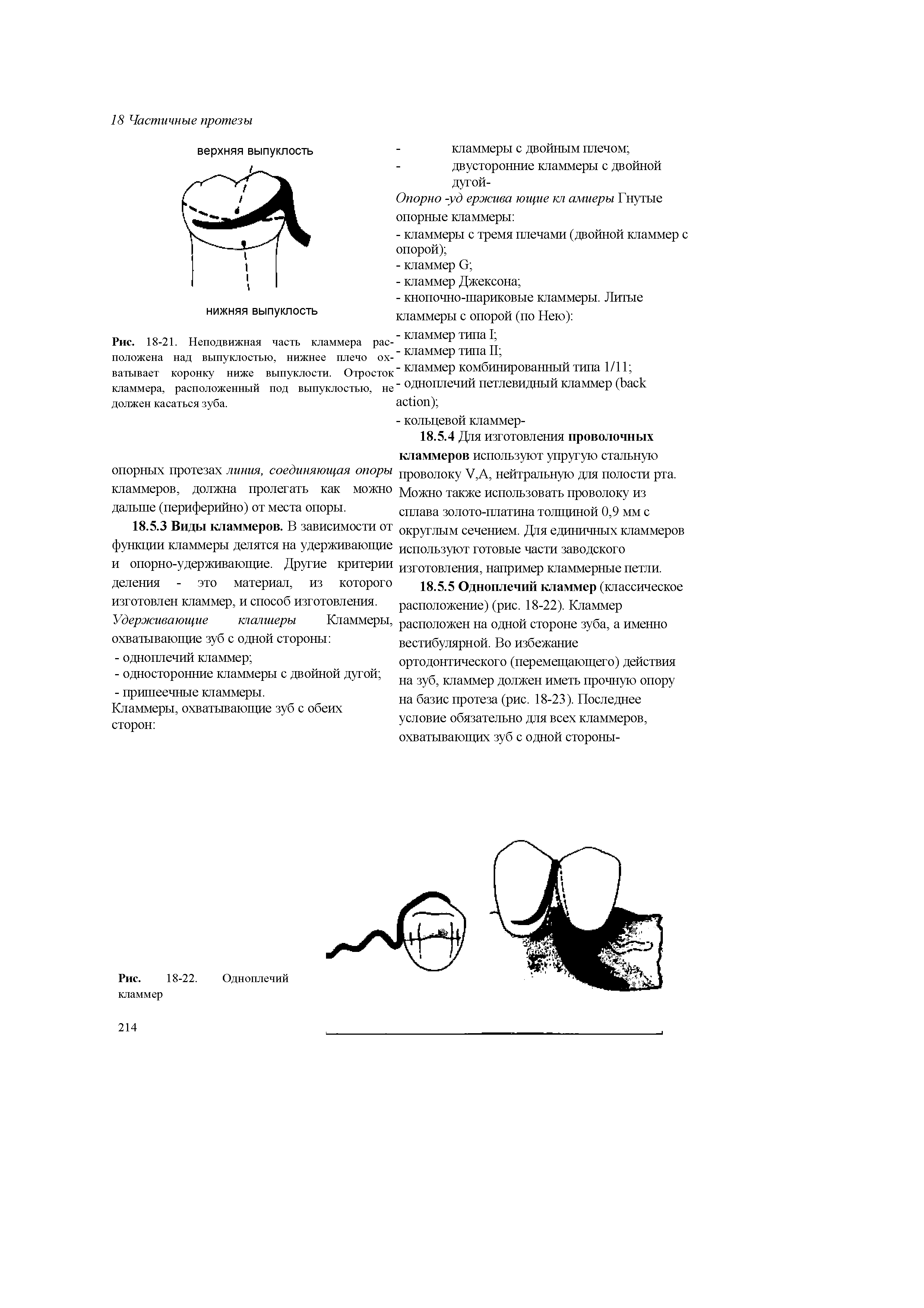 Рис. 18-21. Неподвижная часть кламмера расположена над выпуклостью, нижнее плечо охватывает коронку ниже выпуклости. Отросток кламмера, расположенный под выпуклостью, не должен касаться зуба.