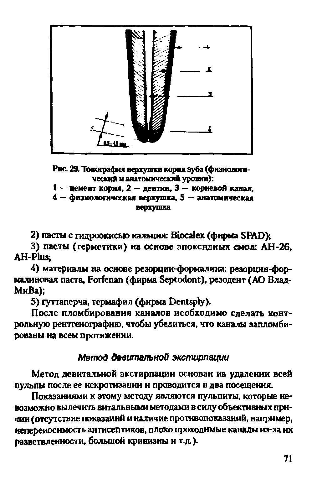 Рис. 29. Топография верхушки корня зуба (физиологический и анатомический уровни) ...