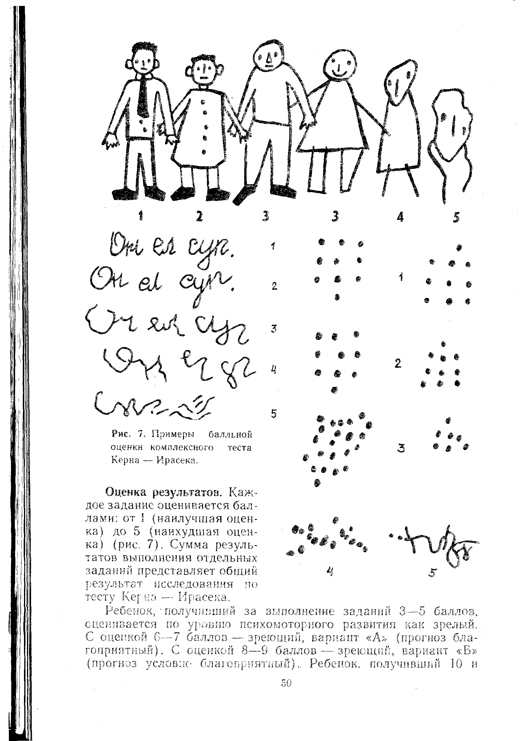 Рис. 7. Примеры балльной оценки комплексного теста Керна — Ирасека.