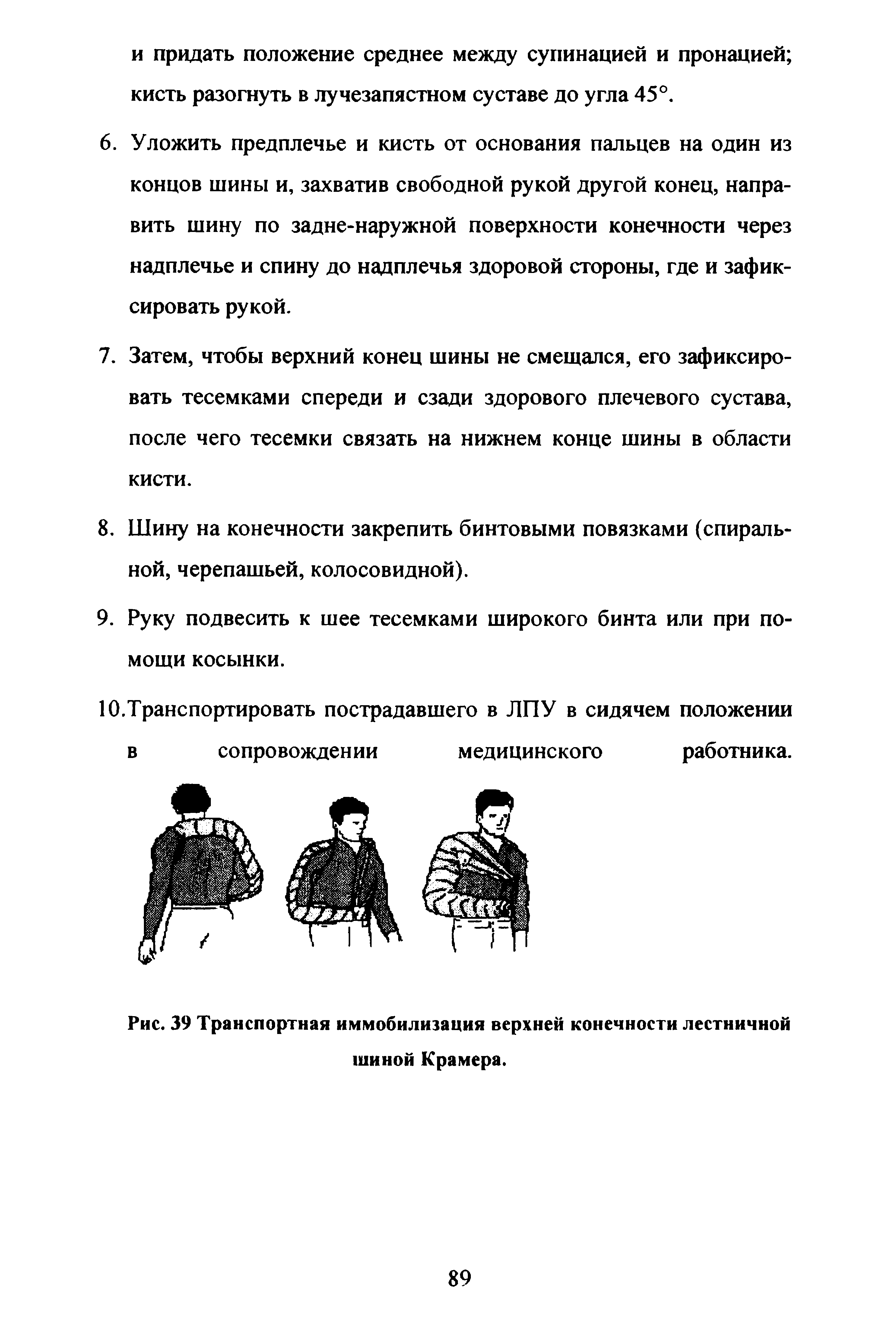 Рис. 39 Транспортная иммобилизация верхней конечности лестничной шиной Крамера.