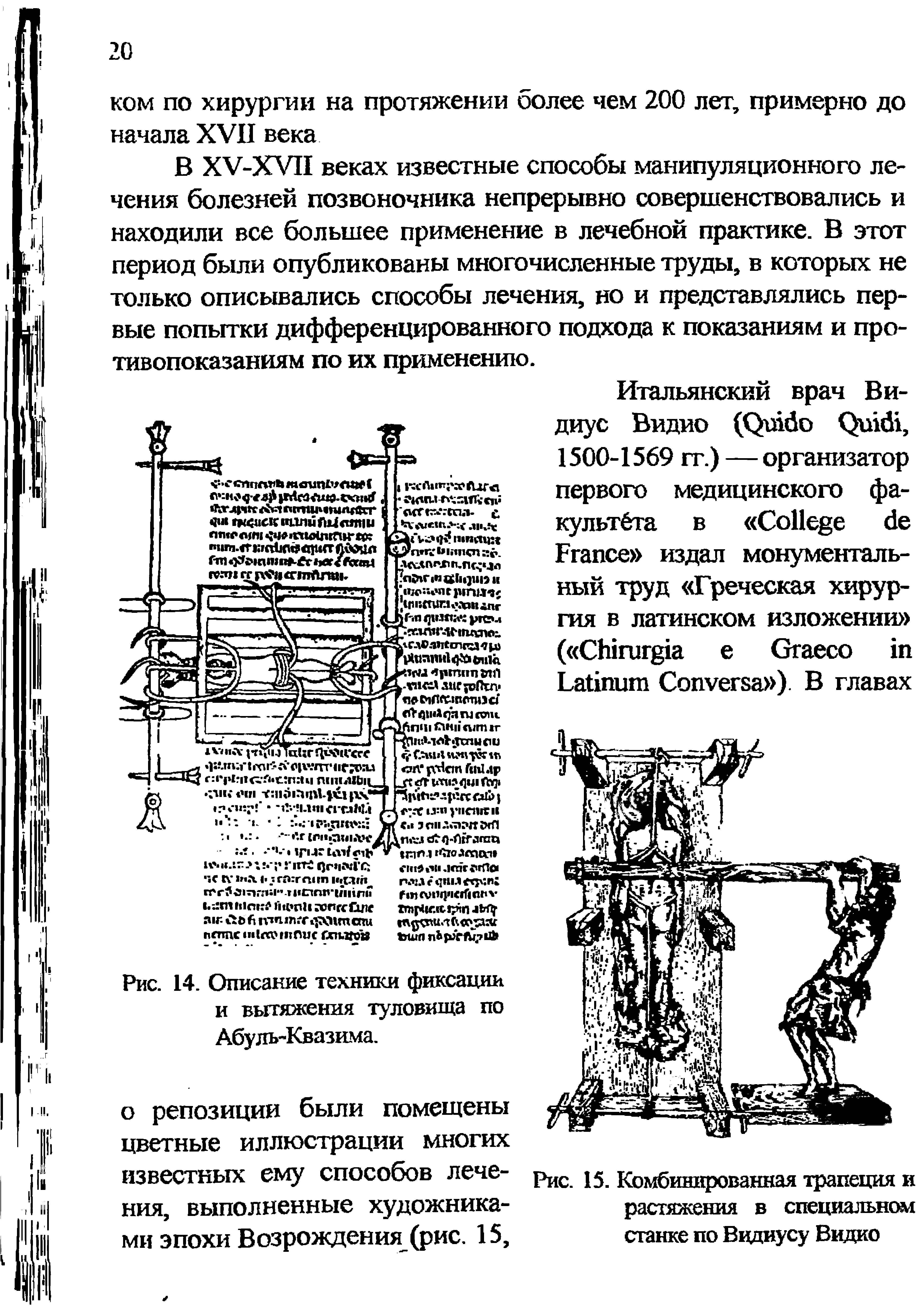 Рис. 14. Описание техники фиксации и вытяжения туловища по Абуль-Квазима.