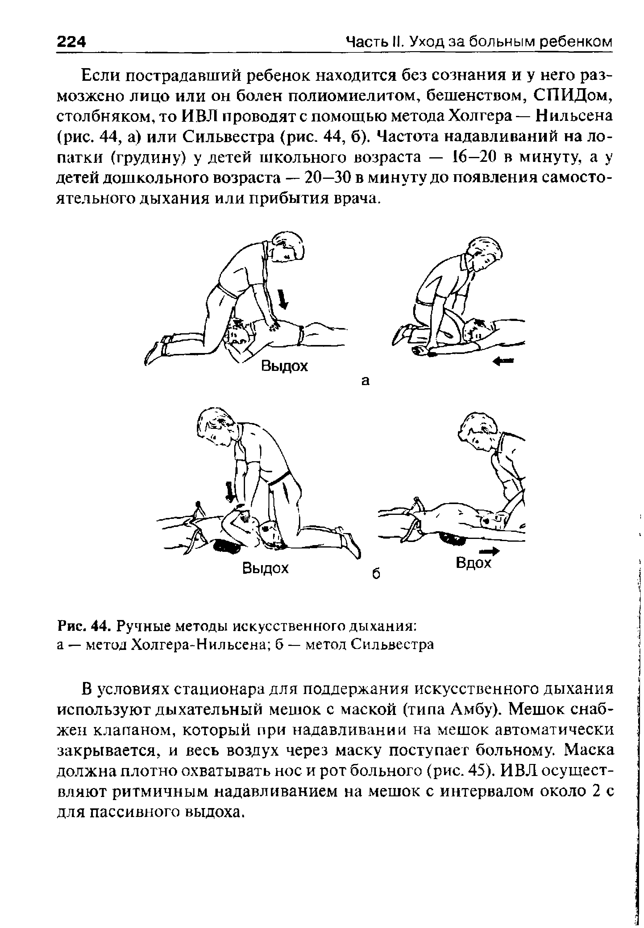 Рис. 44. Ручные методы искусственного дыхания а — метод Холгера-Нильсена б — метол Сильвестра...