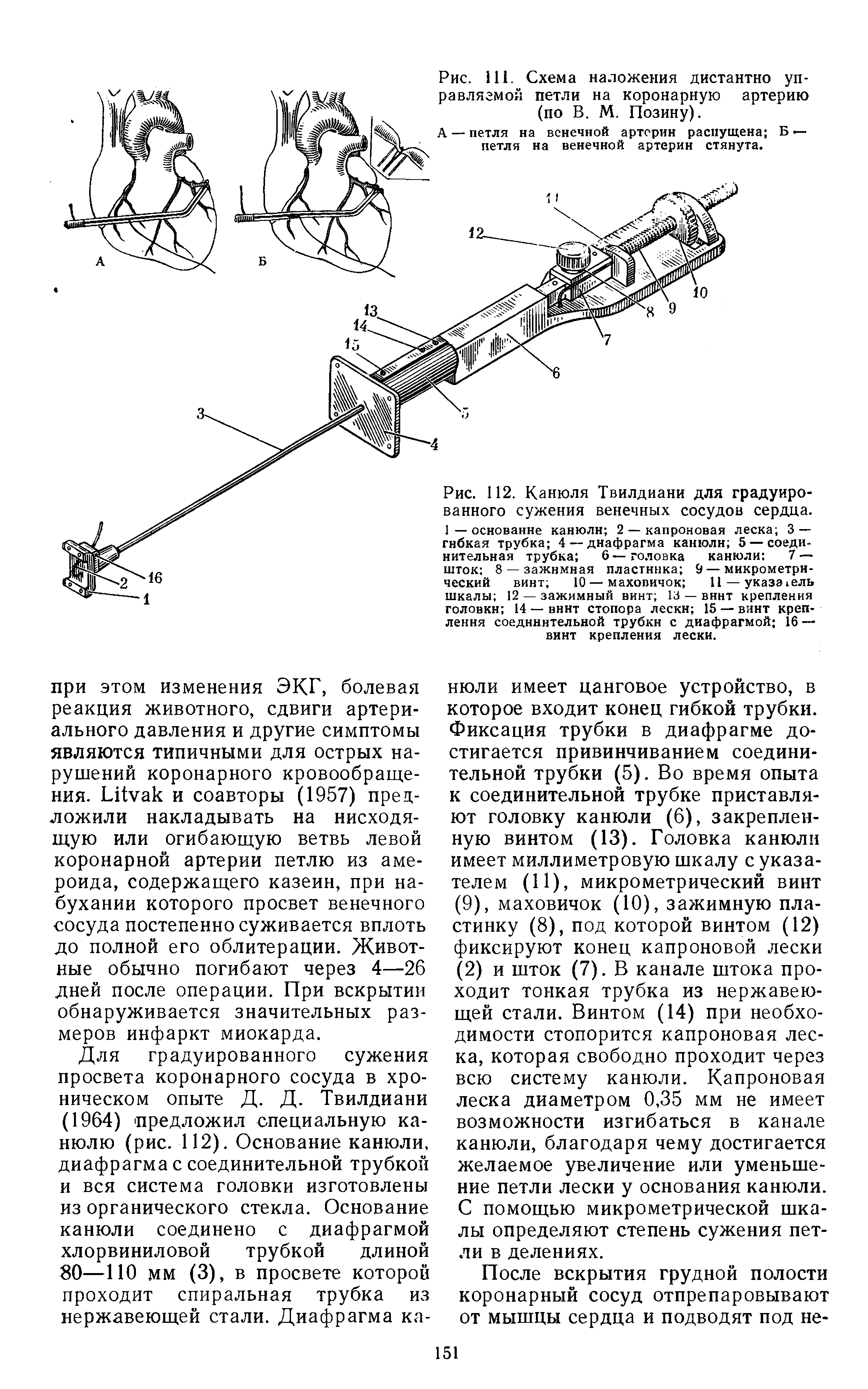 Рис. 111. Схема наложения дистантно управляемой петли на коронарную артерию (по В. М. Позину).