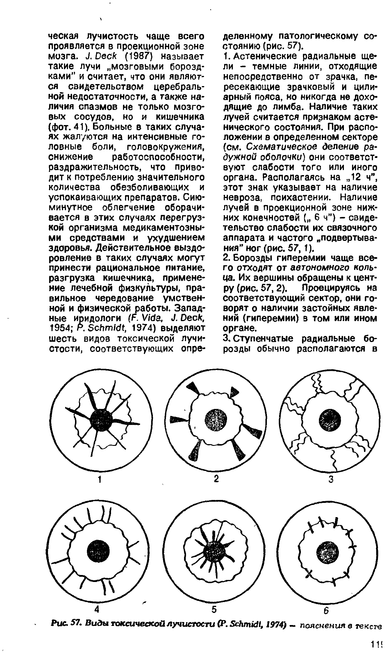 Рис. 57. Виды токсической лучистости (Р. S , 1974) - пояснения в тексте...