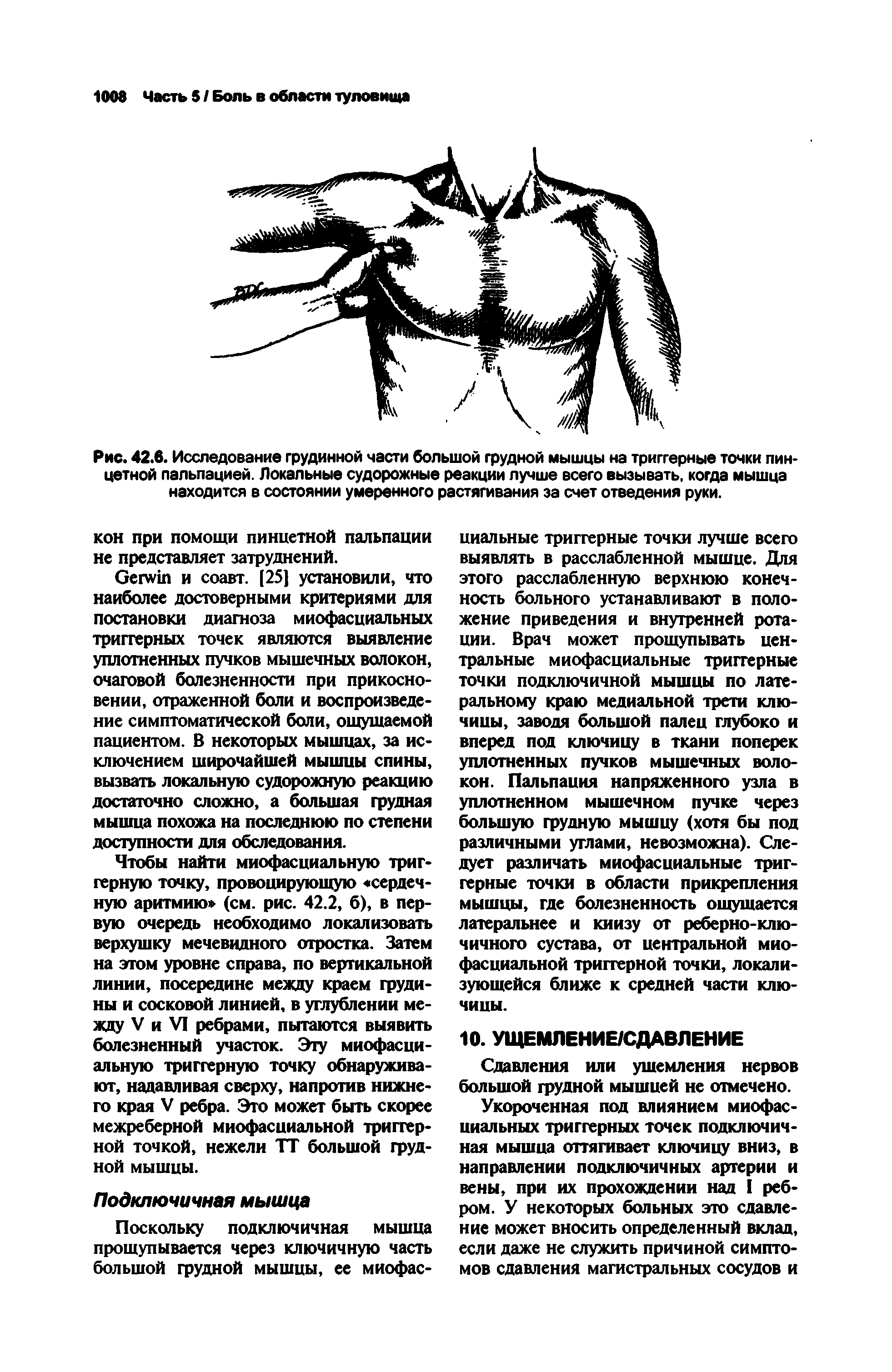 Рис. 42.6. Исследование грудинной части большой грудной мышцы на триггерные точки пин-цетной пальпацией. Локальные судорожные реакции лучше всего вызывать, когда мышца находится в состоянии умеренного растягивания за счет отведения руки.