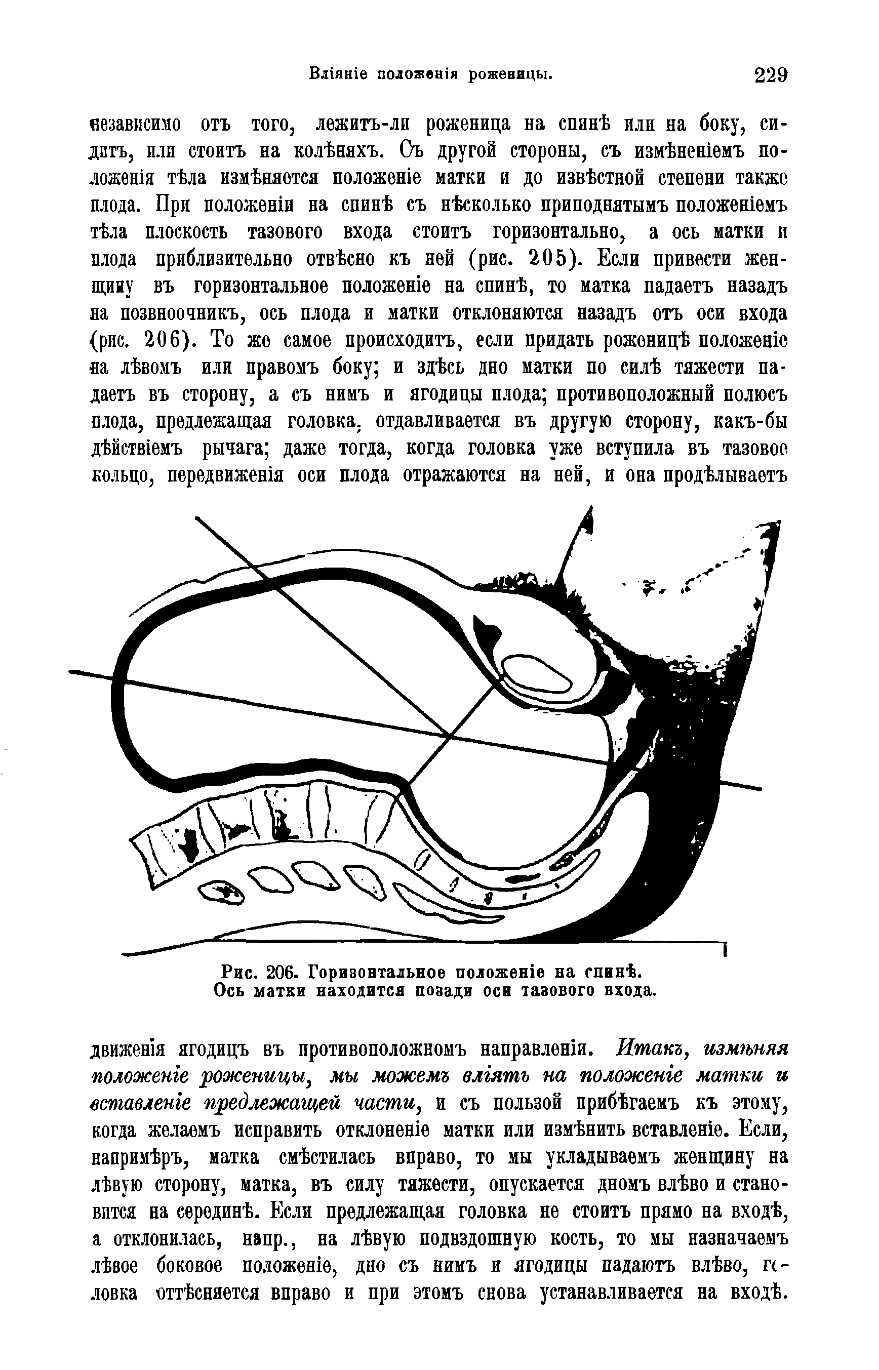 Рис. 206. Горизонтальное положеше на спине. Ось матки находится позади оси тазового входа.