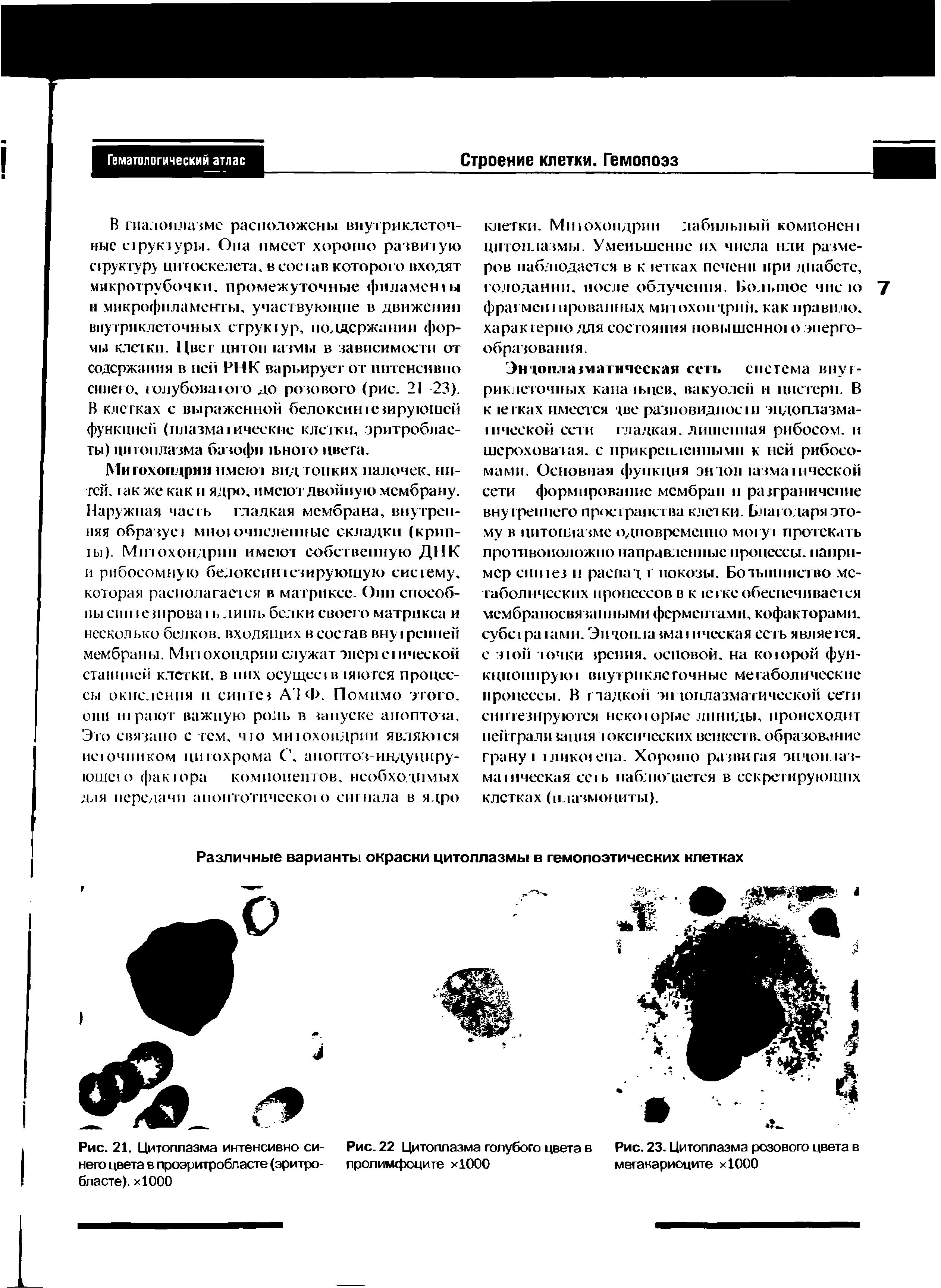 Рис. 21. Цитоплазма интенсивно синего цвета в проэритробласте (эритробласте). хЮОО...