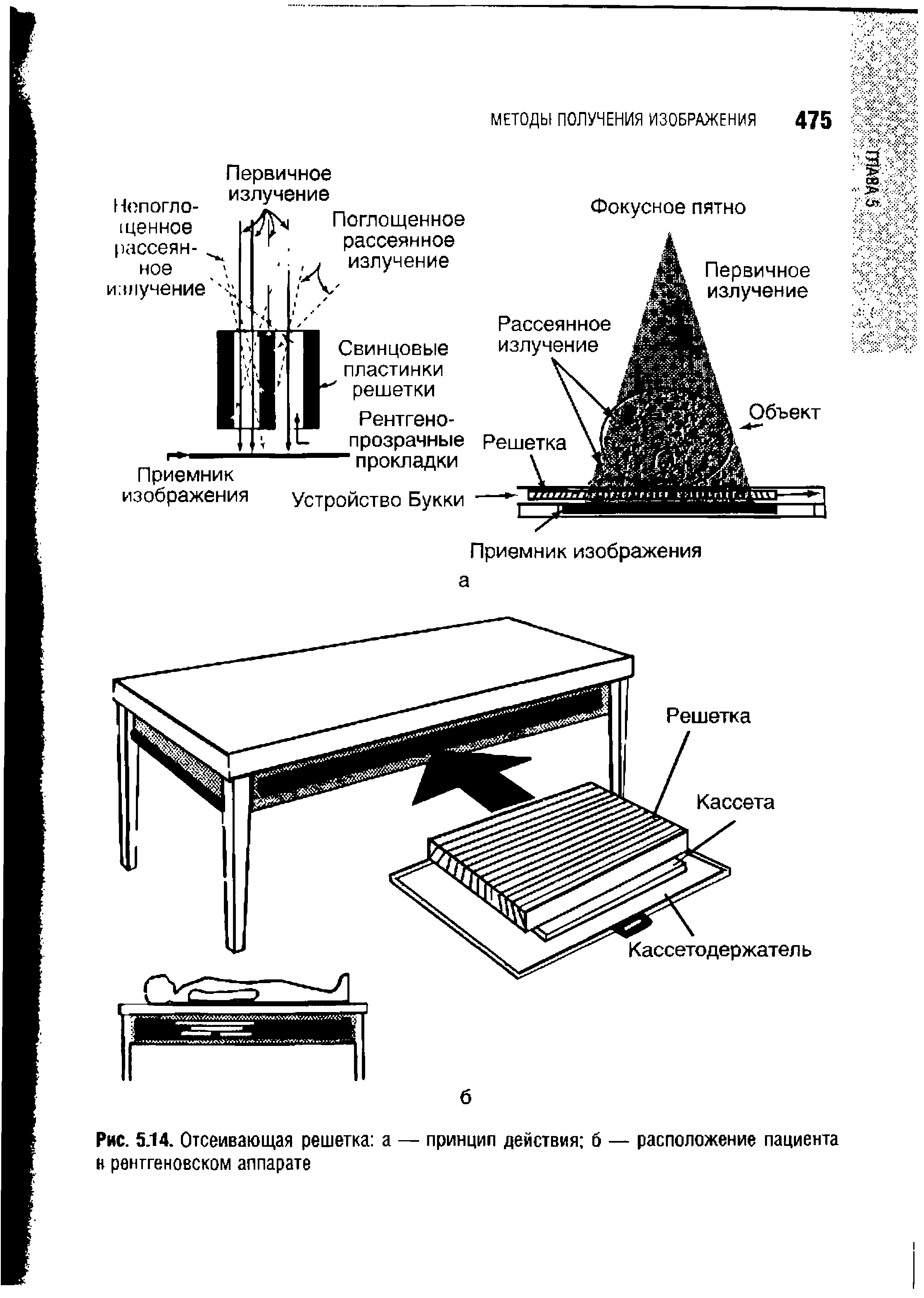 Рис. 5.14. Отсеивающая решетка а — принцип действия б — расположение пациента н рентгеновском аппарате...
