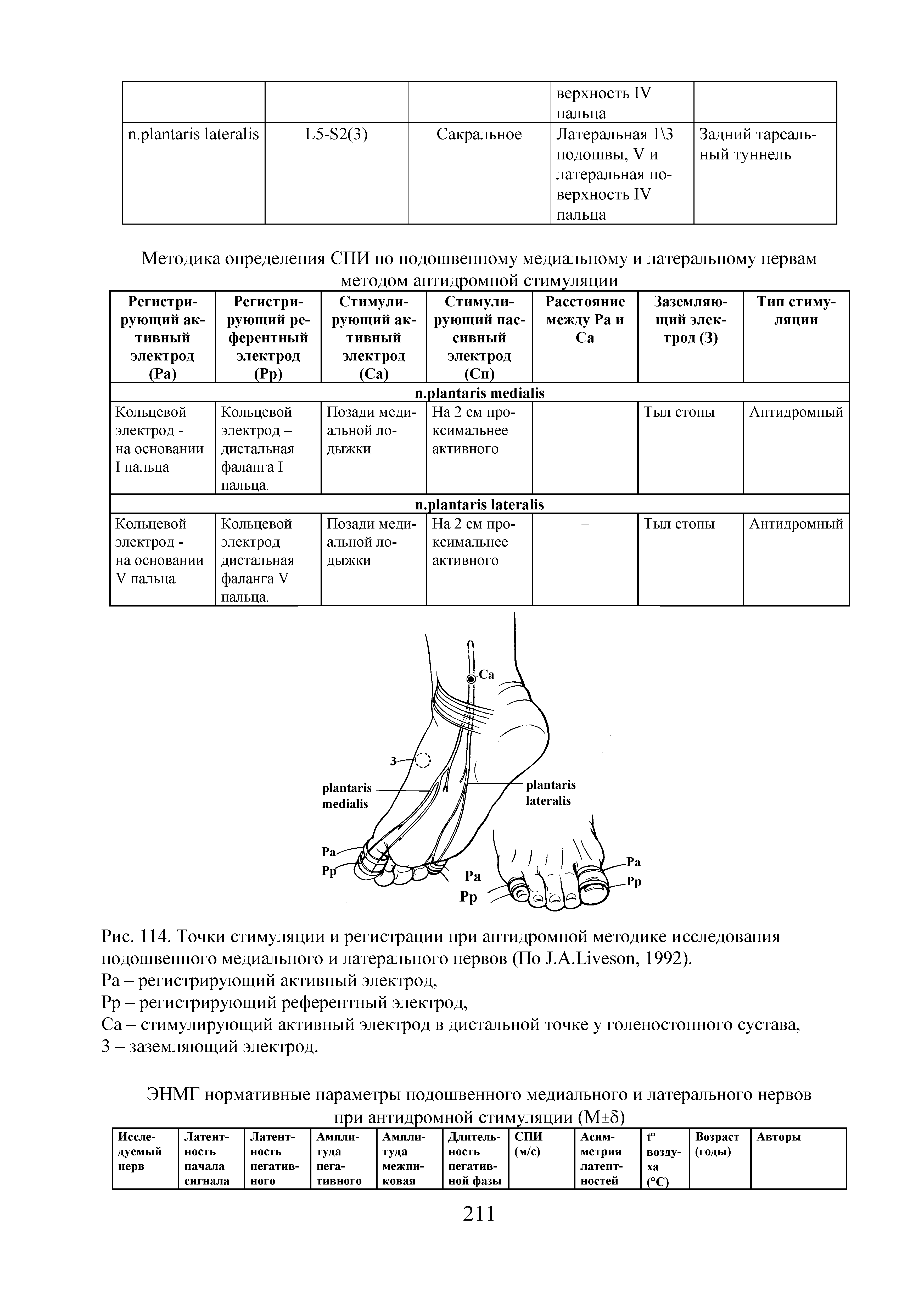 Рис. 114. Точки стимуляции и регистрации при антидромной методике исследования подошвенного медиального и латерального нервов (По ТА.Иуезоп, 1992).