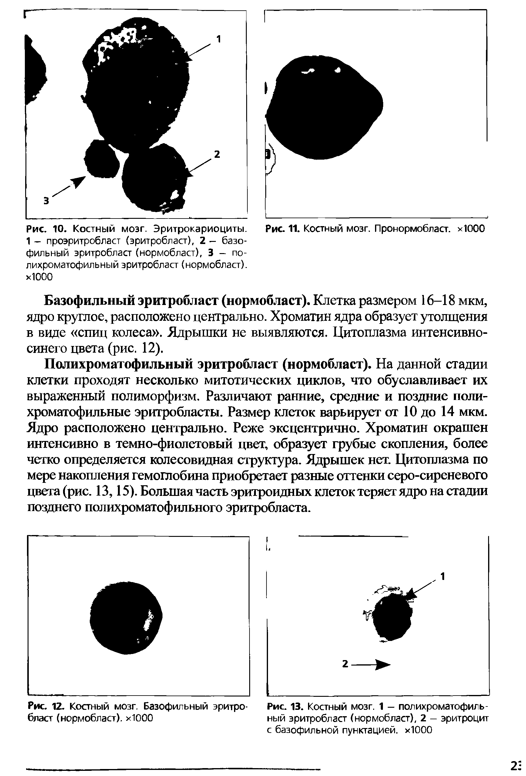 Рис. 13. Костный мозг. 1 — полихроматофильный эритробласт (нормобласт), 2 - эритроцит с базофильной пунктацией. хЮОО...