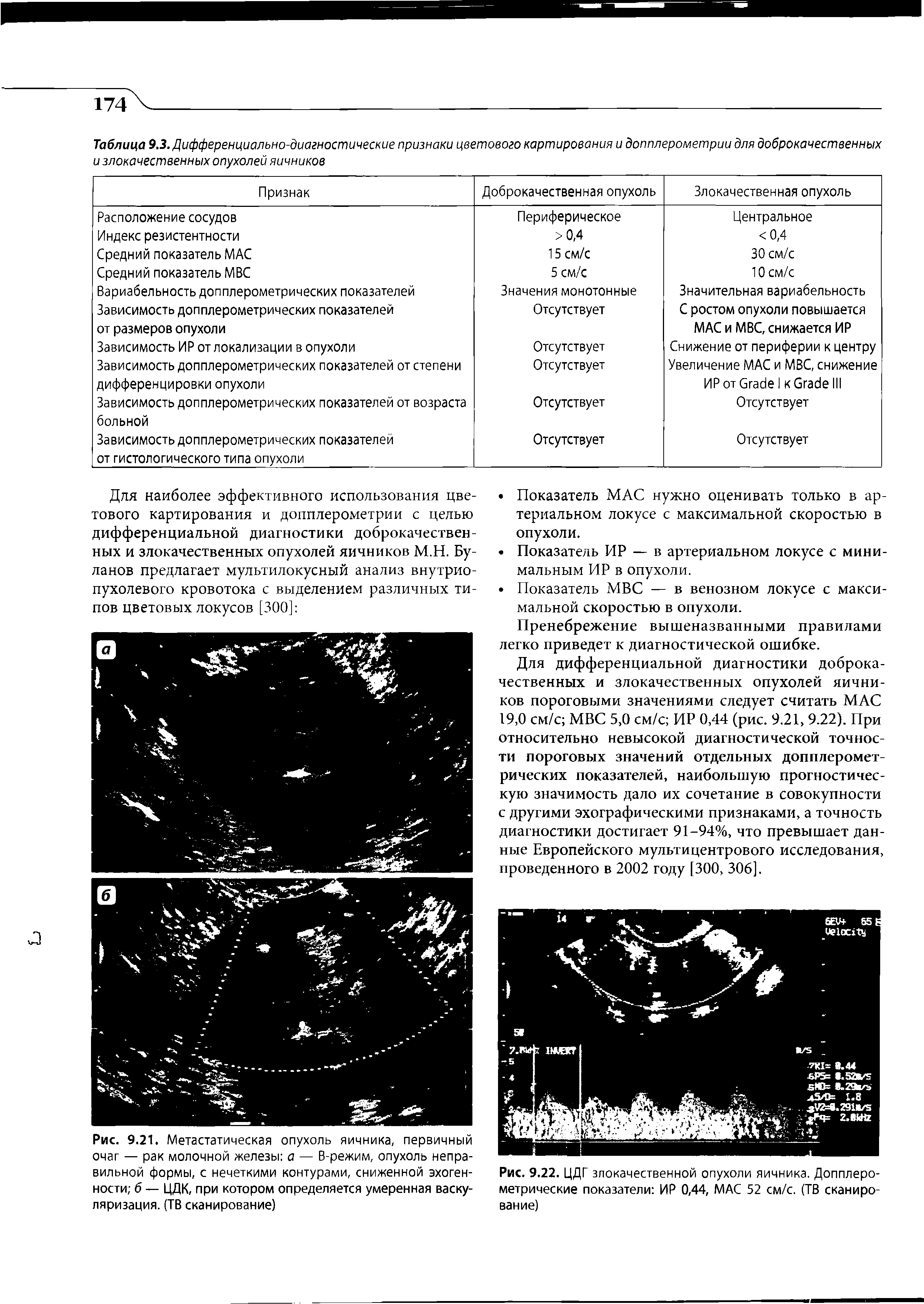 Рис. 9.21. Метастатическая опухоль яичника, первичный очаг — рак молочной железы а — В-режим, опухоль неправильной формы, с нечеткими контурами, сниженной эхогенности б — ЦДК, при котором определяется умеренная васкуляризация. (ТВ сканирование)...