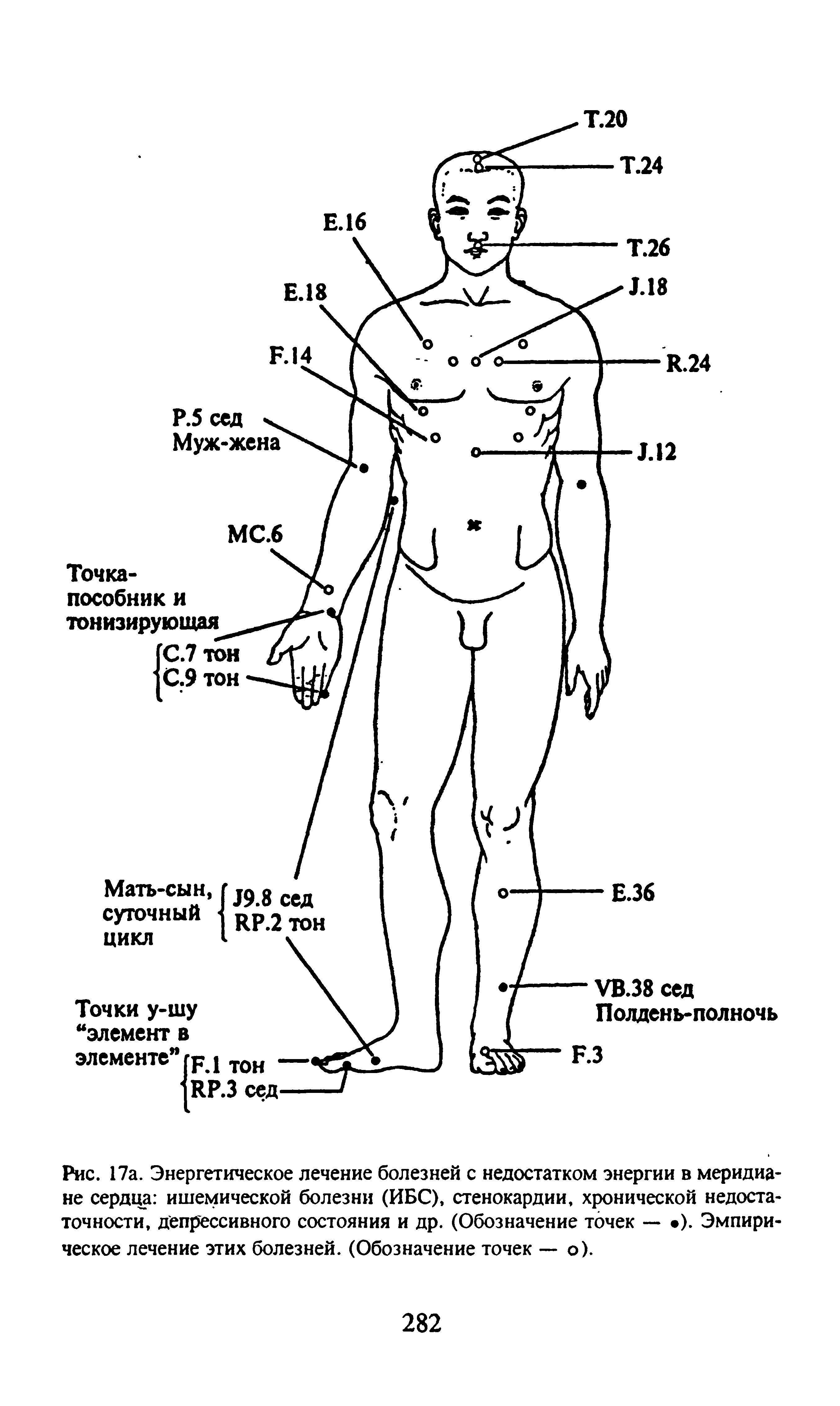 Рис. 17а. Энергетическое лечение болезней с недостатком энергии в меридиане сердца ишемической болезни (ИБС), стенокардии, хронической недостаточности, депрессивного состояния и др. (Обозначение точек — ). Эмпирическое лечение этих болезней. (Обозначение точек — о).