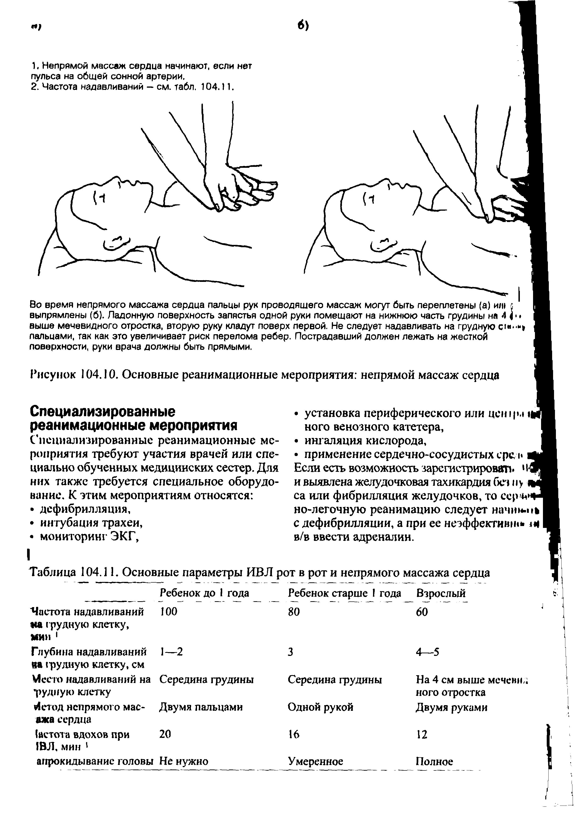 Таблица 104.11. Основные параметры ИВЛ рот в рот и непрямого массажа сердца...