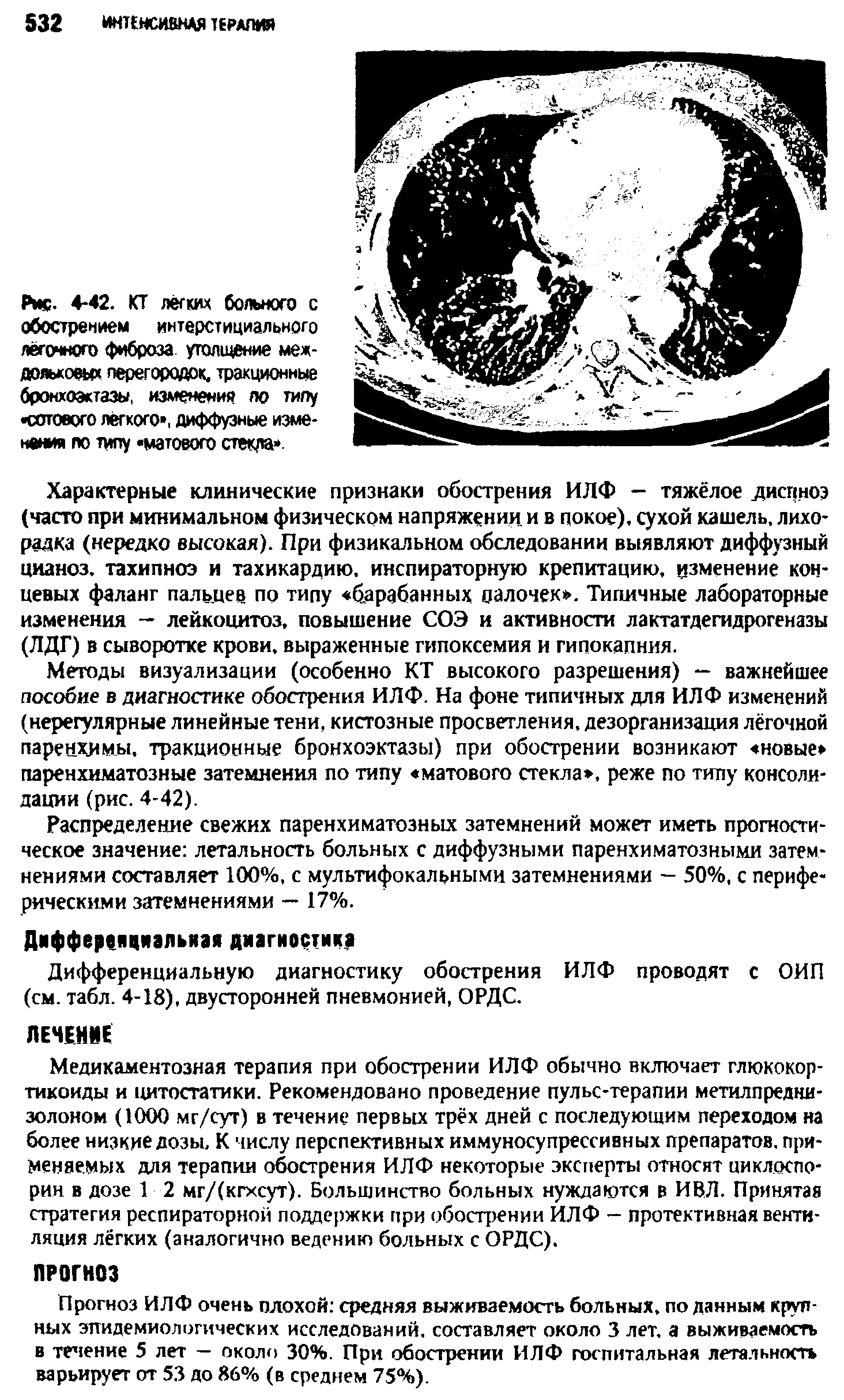 Рис. 4-42. КТ легких больного с обострением интерстициального легочного фиброза утолщение междольковых перегородок, тракционные бронхоэктазы, изменения по типу сотового лёгкого , диффузные изменения по типу матового стекла ...