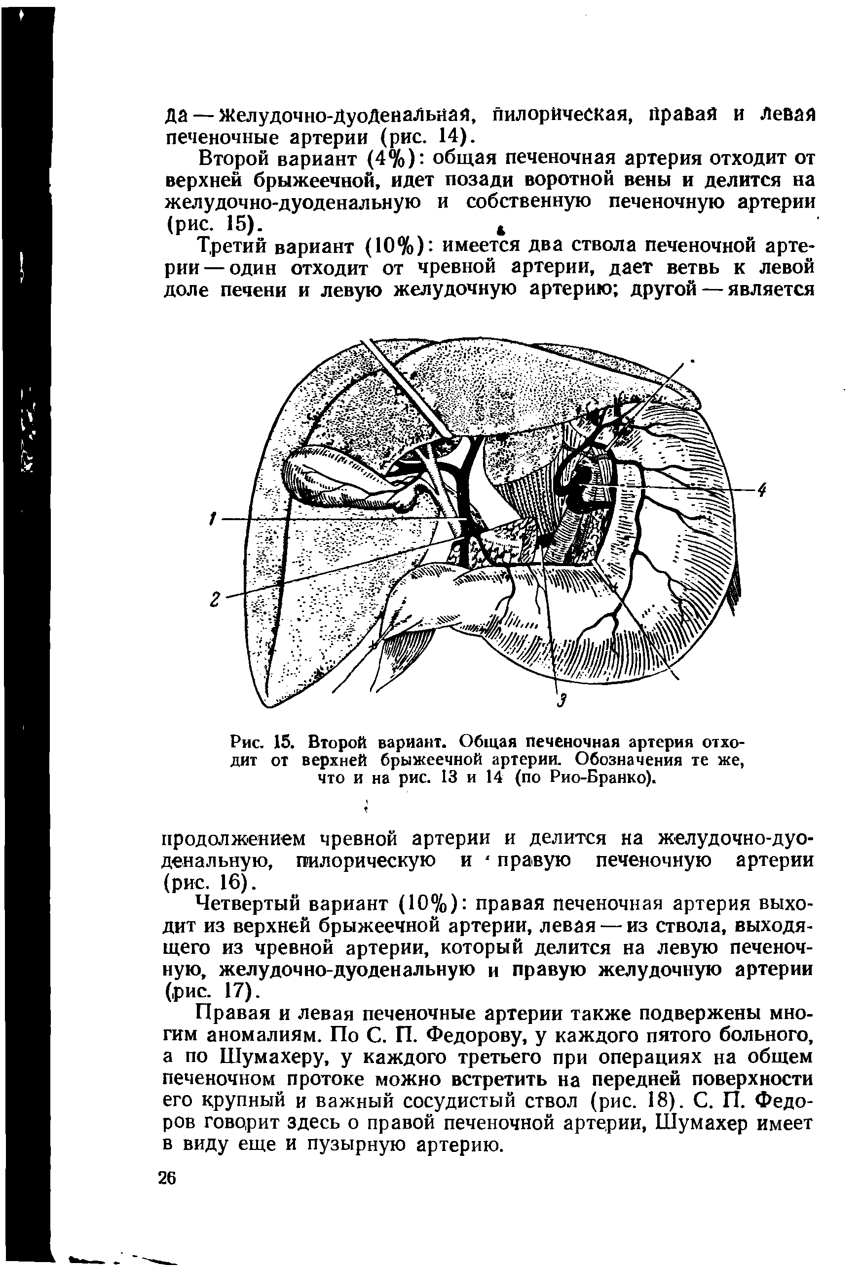 Рис. 15. Второй вариант. Общая печеночная артерия отходит от верхней брыжеечной артерии. Обозначения те же, что и на рис. 13 и 14 (по Рио-Бранко).