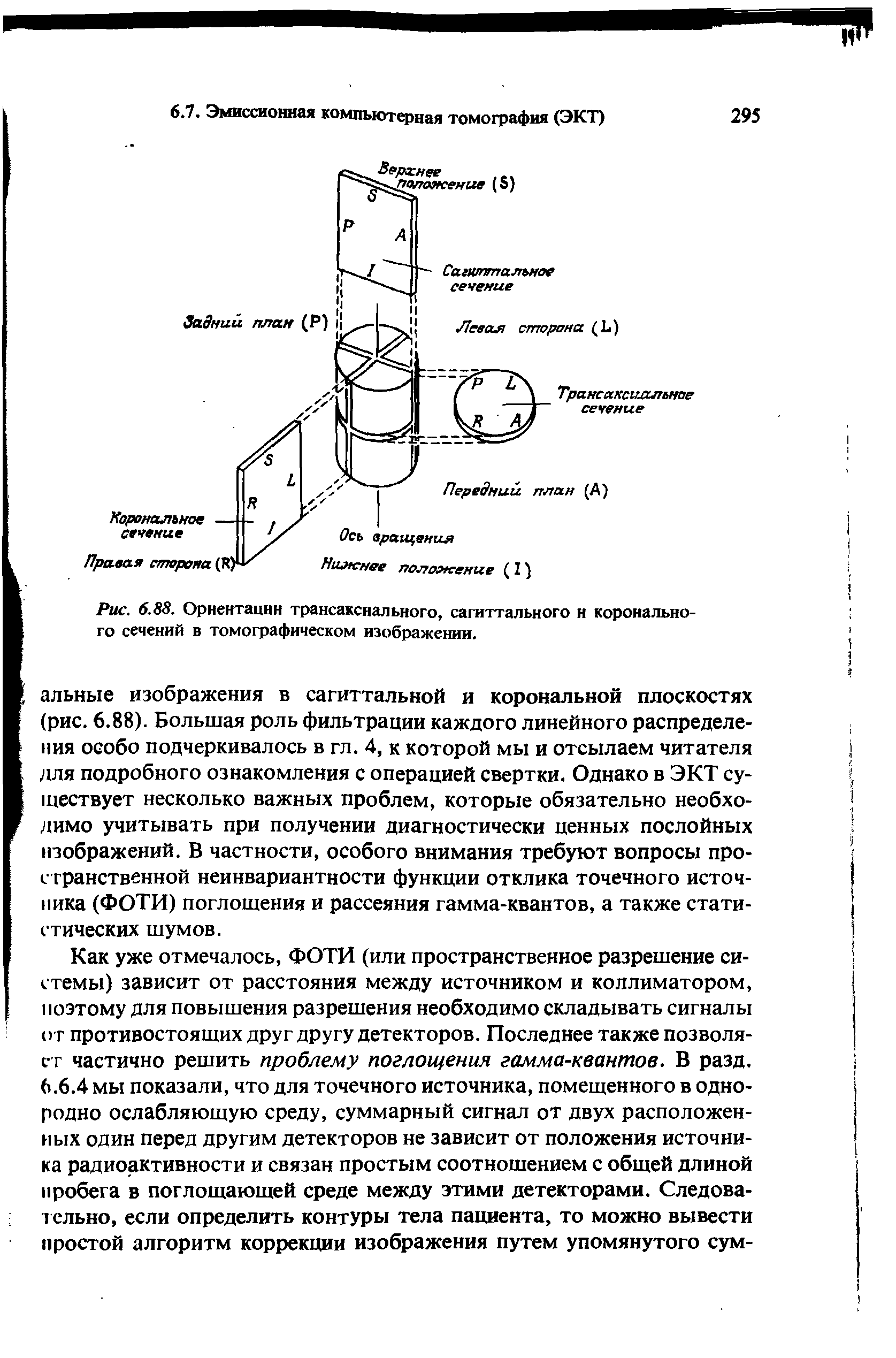 Рис. 6.88. Ориентации трансакснального, сагиттального н коронально-го сечений в томографическом изображении.