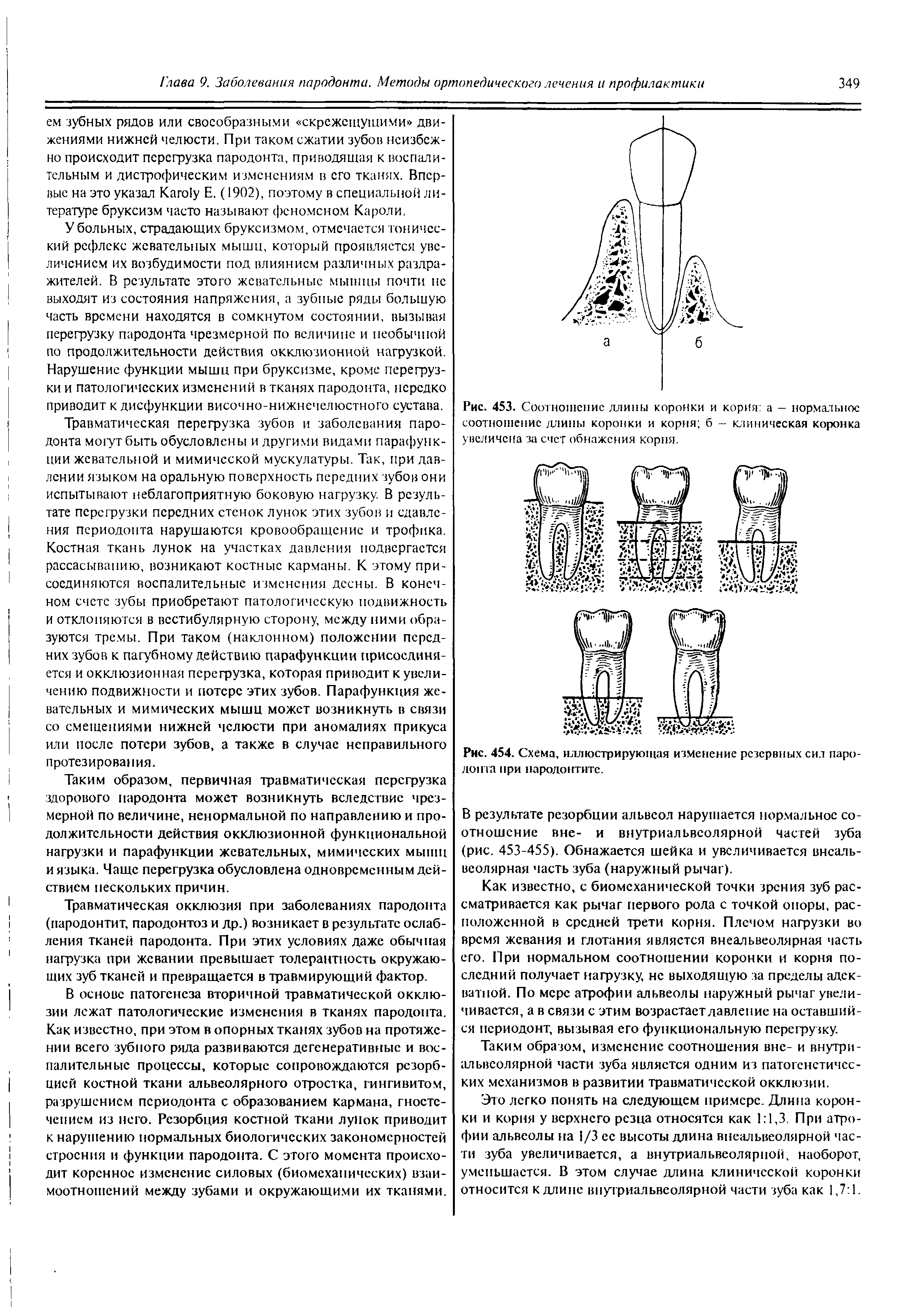 Рис. 453. Соотношение длины коронки и корпя а - нормальное соотношение длины коронки и корня б — клиническая коронка увеличена за счет обнажения корня.