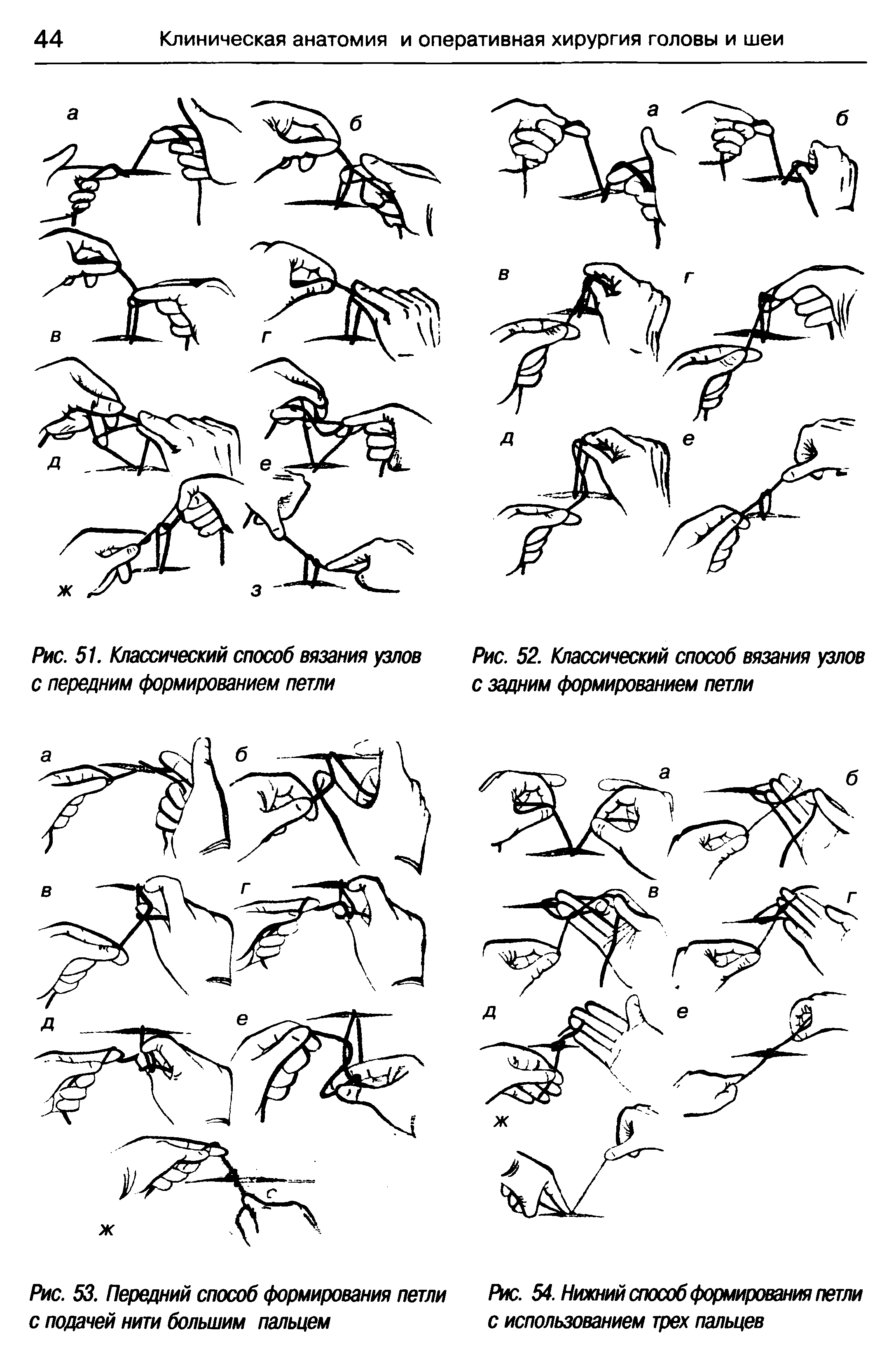 Рис. 54. Нижний способ формирования петли с использованием трех пальцев...