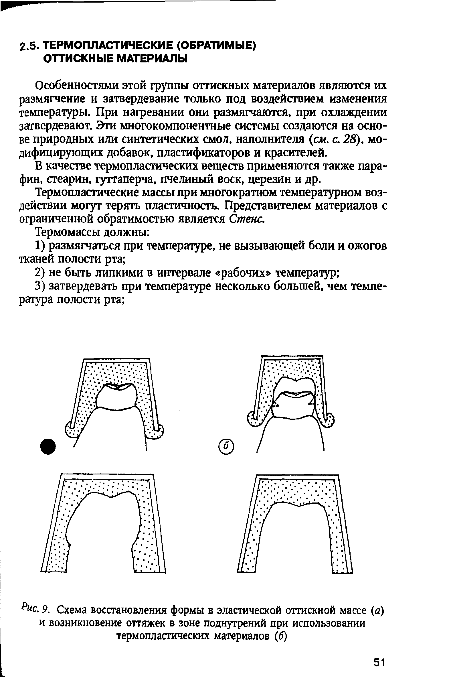 Рис. 9. Схема восстановления формы в эластической оттискной массе (а) и возникновение оттяжек в зоне поднутрений при использовании термопластических материалов (б)...