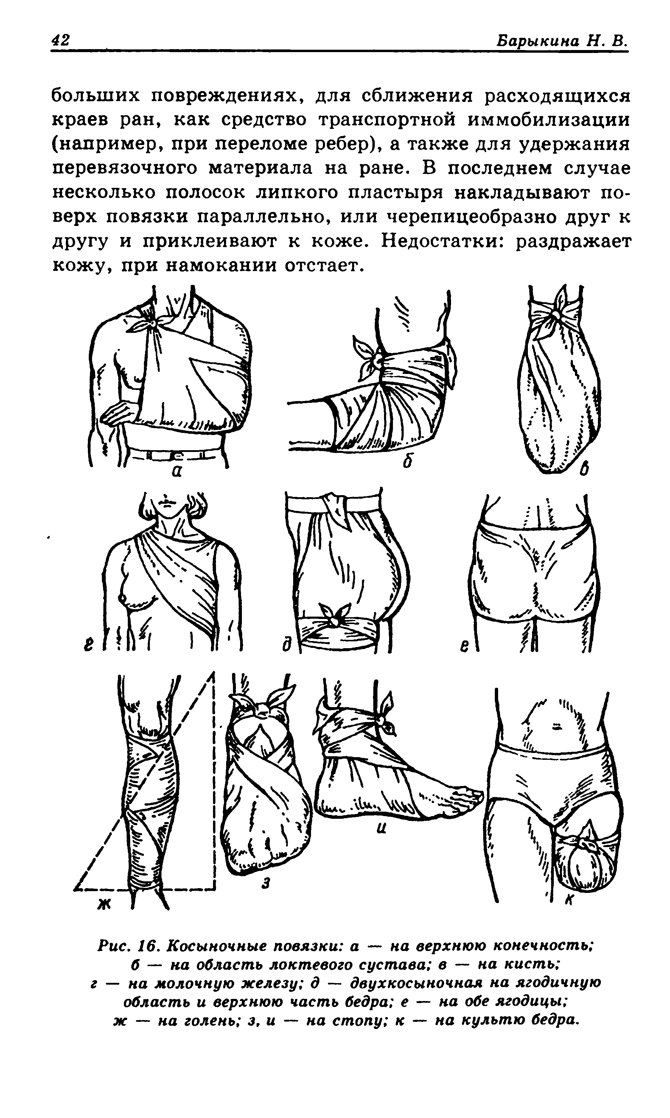 Рис. 16. Косыночные повязки а — на верхнюю конечность б — на область локтевого сустава в — на кисть г-на молочную железу д — двухкосыночная на ягодичную область и верхнюю часть бедра е — на обе ягодицы ж — на голень з, и — на стопу к — на культю бедра.