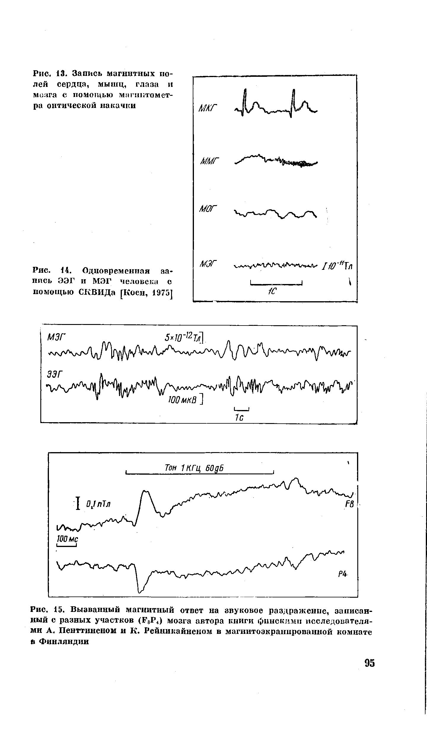 Рис. 15. Вызванный магнитный ответ на звуковое раздражение, записанный с разных участков (Г8Р4) мозга автора книги финскими исследователями А. Пенттиненом и К. Рейникайненом в магнитоэкранпрованной комнате в Финляндии...