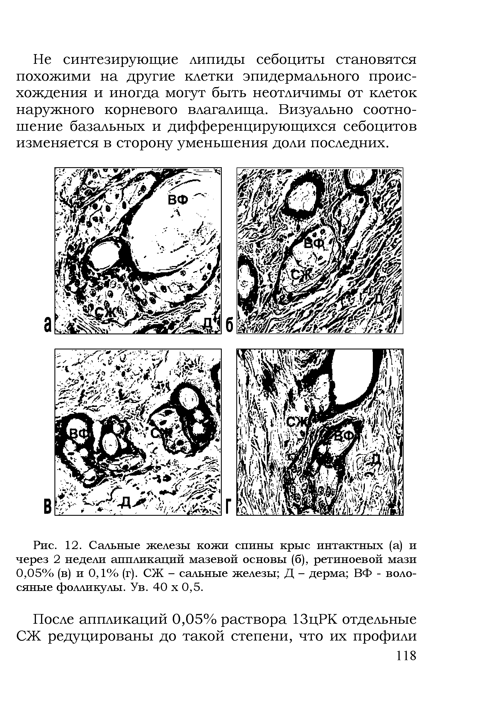 Рис. 12. Сальные железы кожи спины крыс интактных (а) и через 2 недели аппликаций мазевой основы (б), ретиноевой мази 0,05% (в) и 0,1% (г). СЖ - сальные железы Д - дерма ВФ - волосяные фолликулы. Ув. 40 х 0,5.