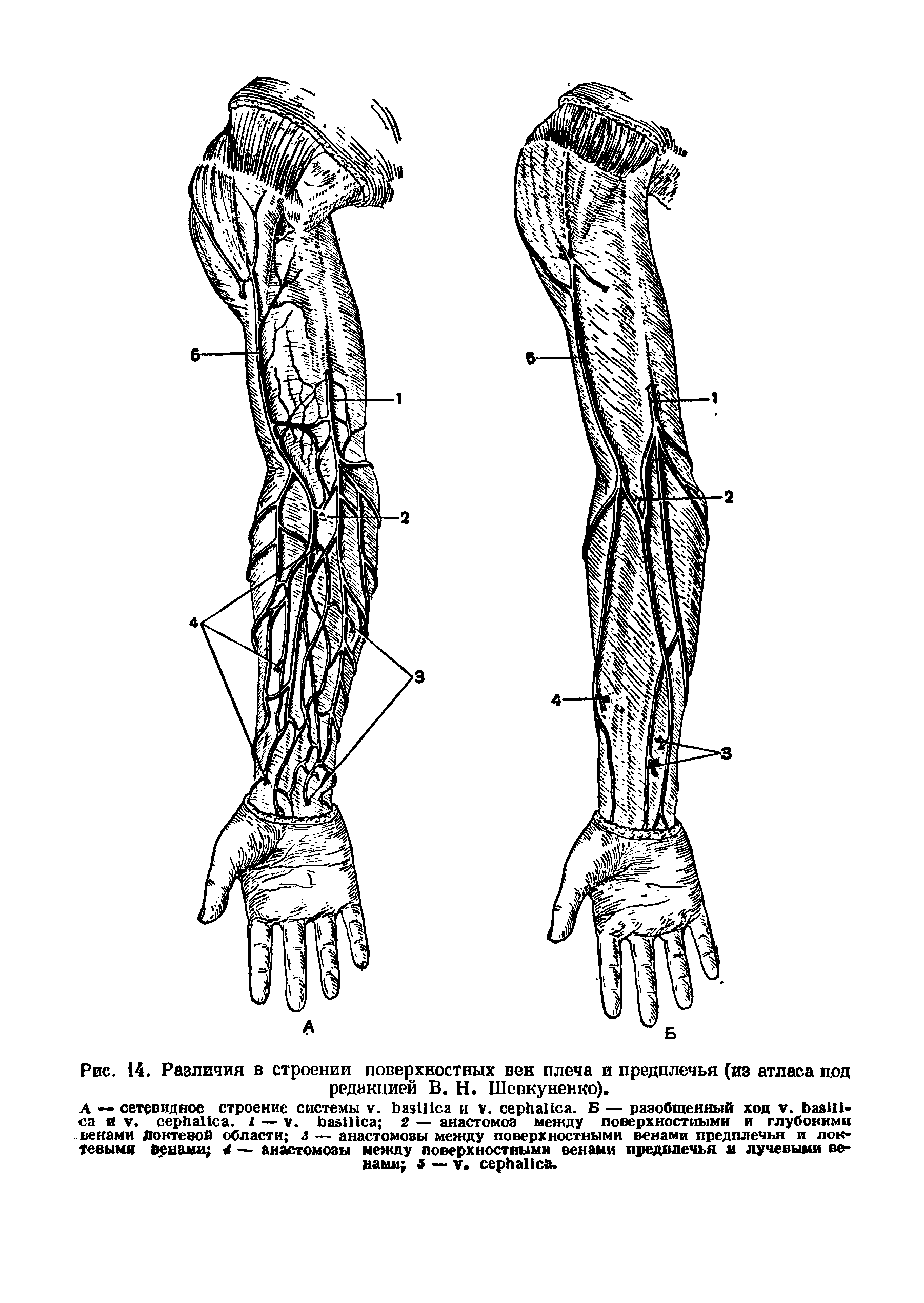 Рис. 14. Различия в строении поверхностных вен плеча и предплечья (из атласа п.од редакцией В. Н. Шевкуненко).