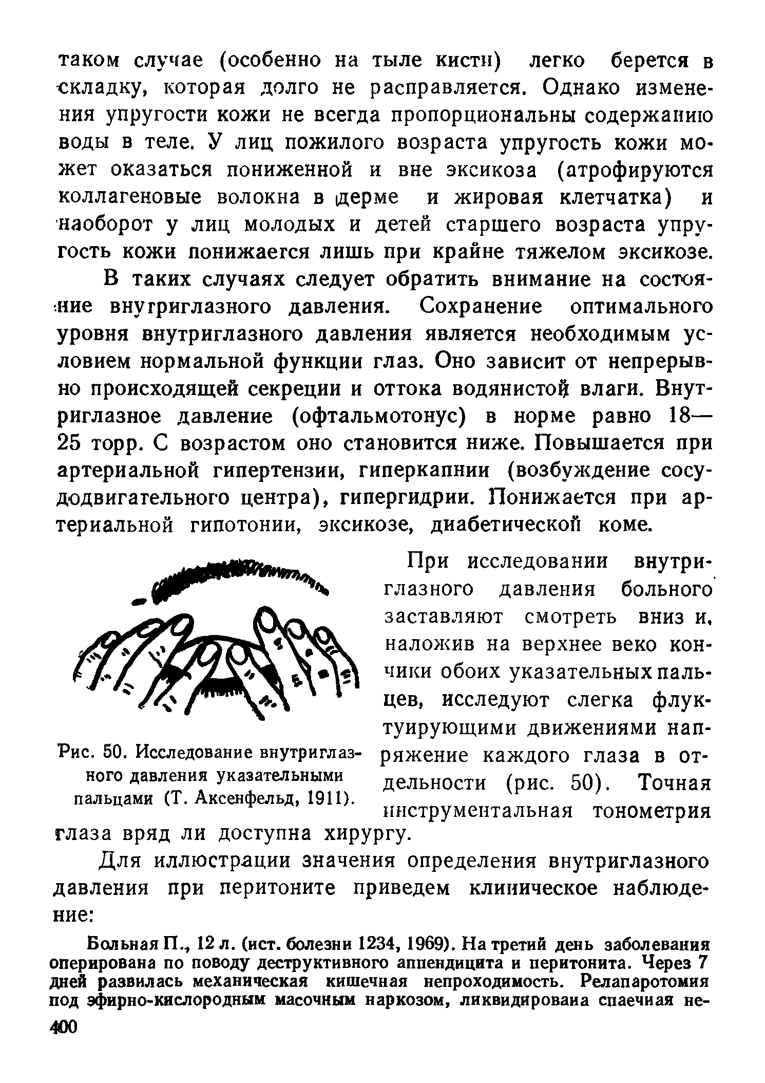 Рис. 50. Исследование внутриглазного давления указательными пальцами (Т. Аксенфельд, 1911).