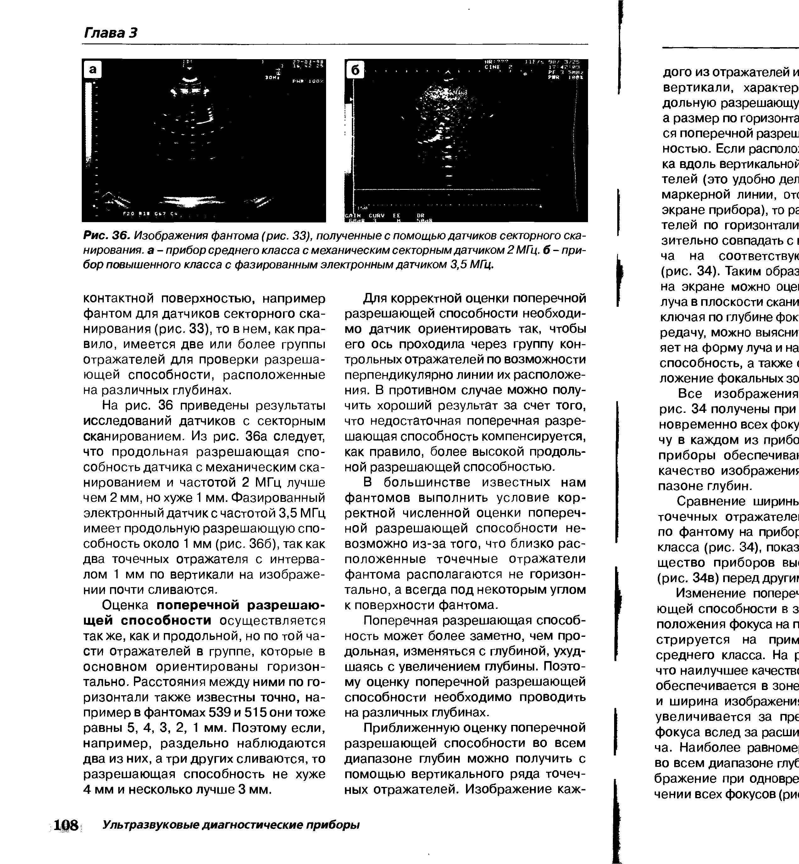 Рис. 36. Изображения фантома (рис. 33), полученные с помощью датчиков секторного сканирования. а - прибор среднего класса с механическим секторным датчиком 2 МГц. 6 - прибор повышенного класса с фазированным электронным датчиком 3,5 МГц.