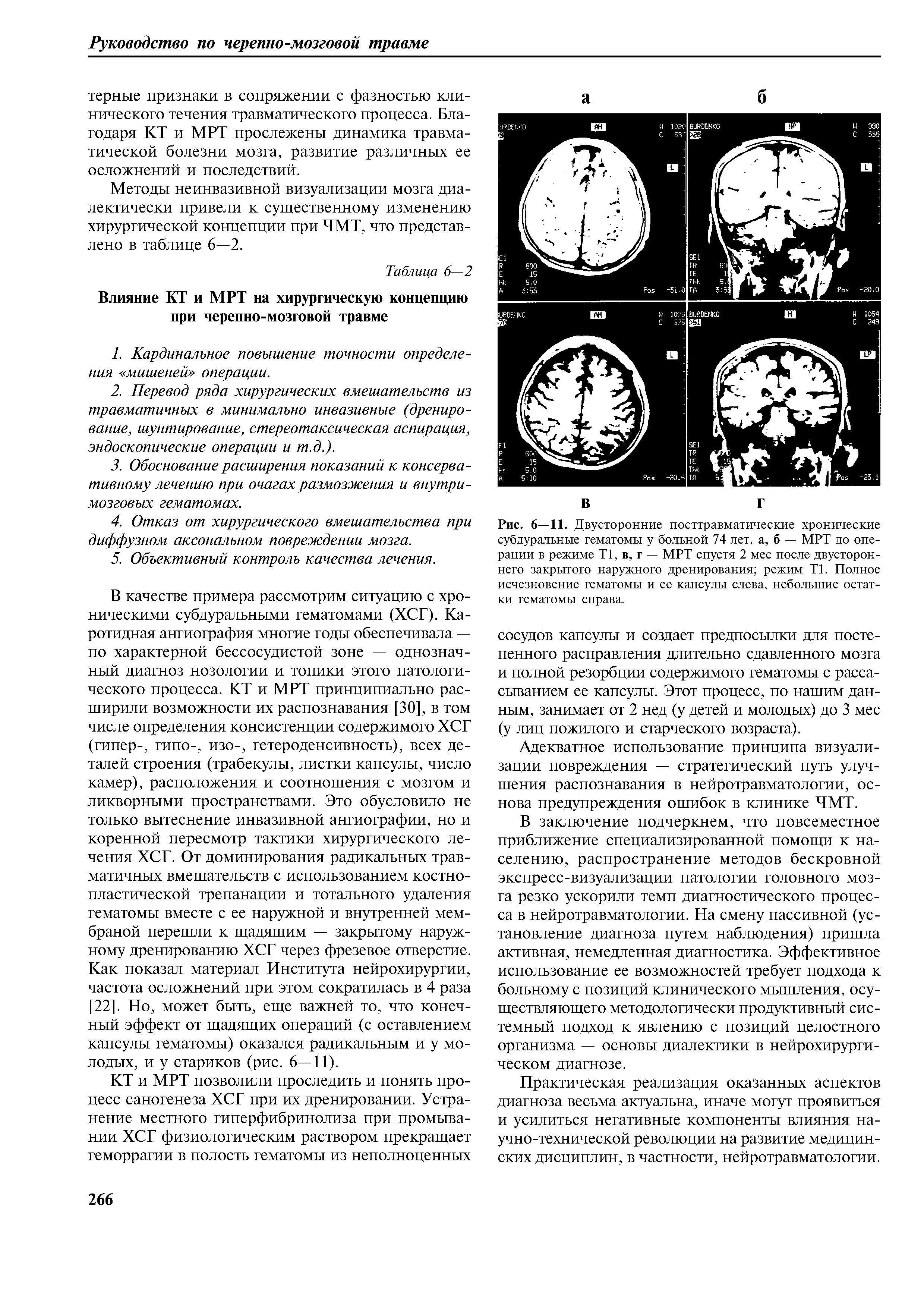 Рис. 6—11. Двусторонние посттравматические хронические субдуральные гематомы у больной 74 лет. а, б — МРТ до операции в режиме Т1, в, г — МРТ спустя 2 мес после двустороннего закрытого наружного дренирования режим Т1. Полное исчезновение гематомы и ее капсулы слева, небольшие остатки гематомы справа.