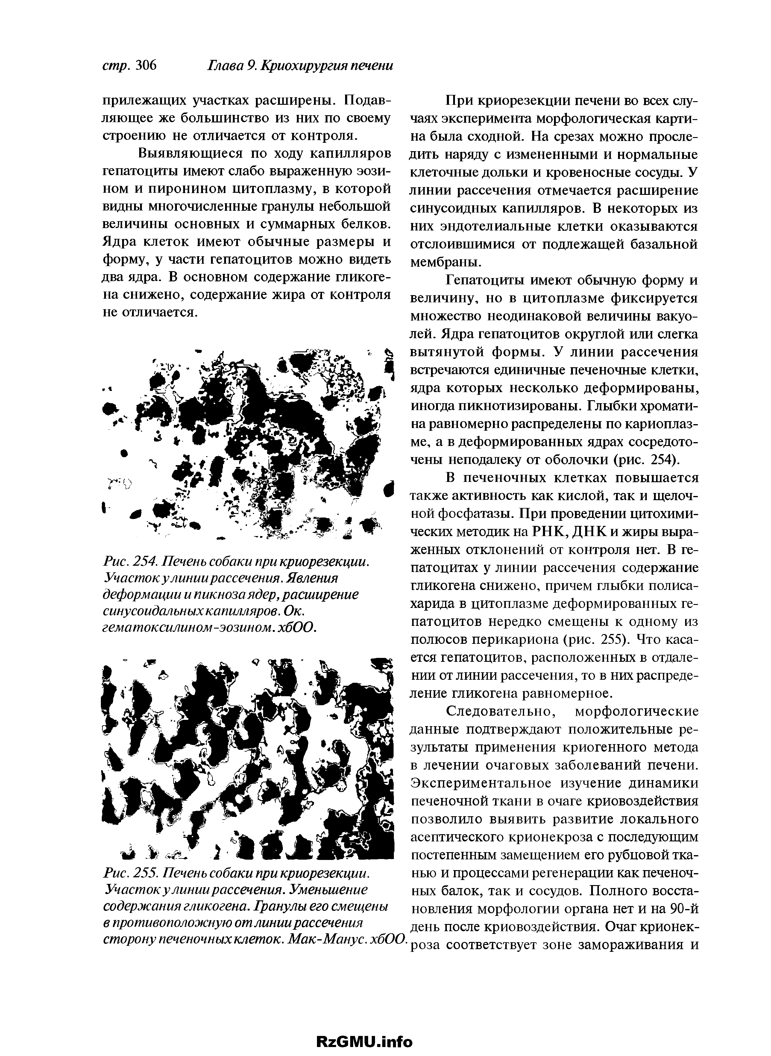 Рис. 255. Печень собаки при криорезекции. Участок у линии рассечения. Уменьшение содержания гликогена. Гранулы его смещены в противоположную от линии рассечения сторону печеночных клеток. Мак-Манус. хбОО...