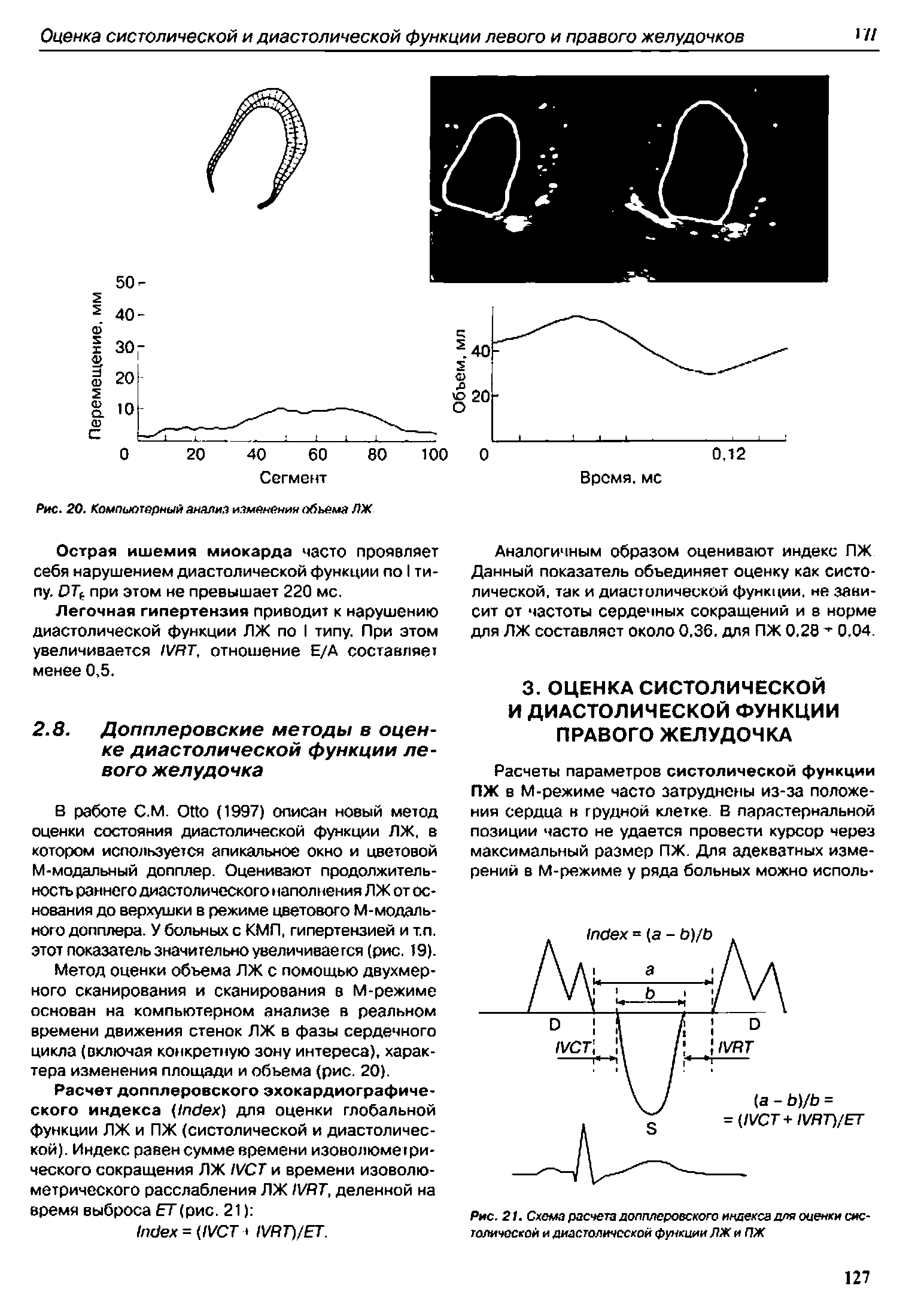 Рис. 21. Схема расчета допплеровского индекса для опенки систолической и диастолической функции ЛЖ и ПЖ...