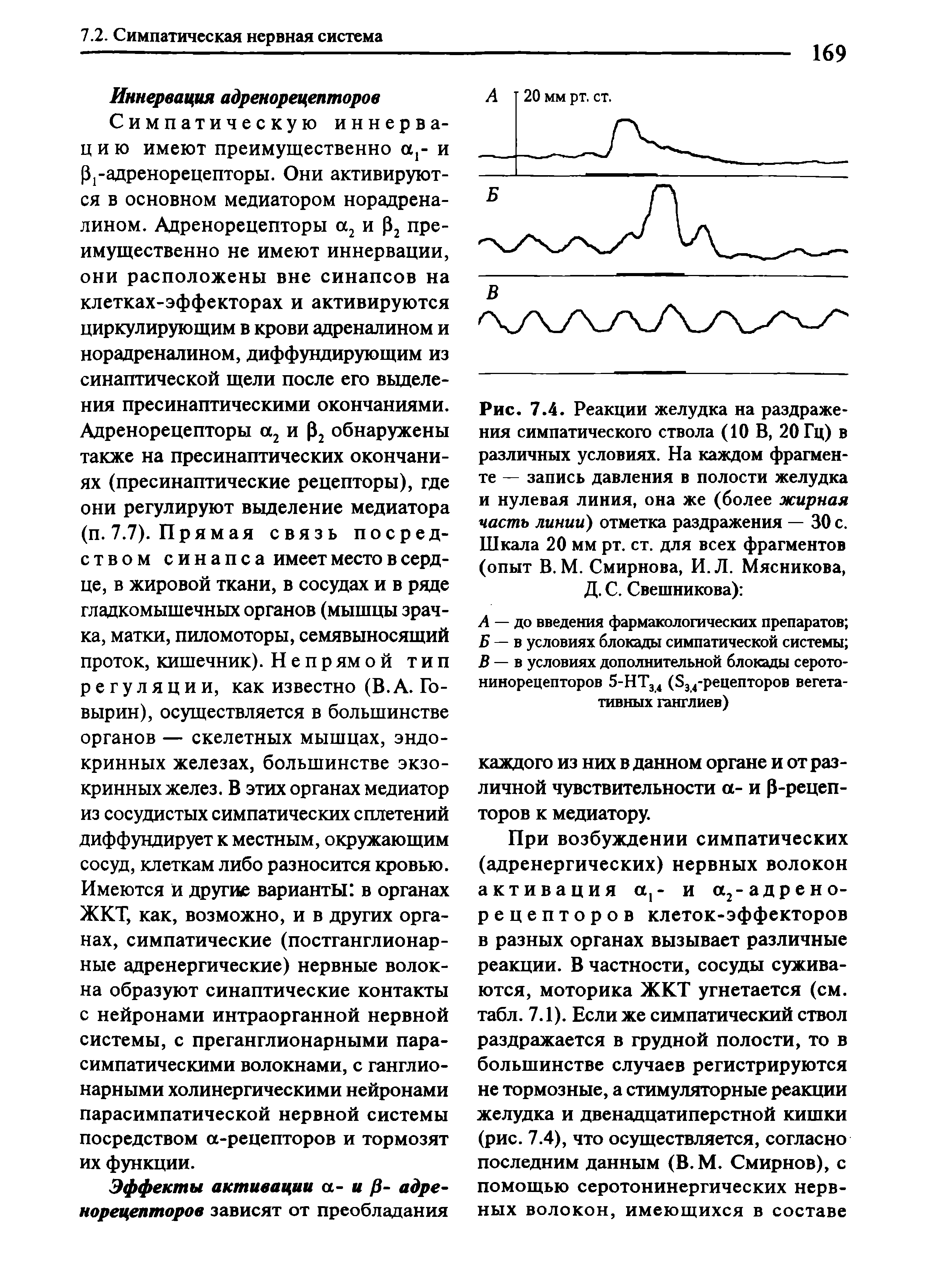 Рис. 7.4. Реакции желудка на раздражения симпатического ствола (10 В, 20 Гц) в различных условиях. На каждом фрагменте — запись давления в полости желудка и нулевая линия, она же (более жирная часть линий) отметка раздражения — 30 с. Шкала 20 мм рт. ст. для всех фрагментов (опыт В. М. Смирнова, И. Л. Мясникова, Д. С. Свешникова) ...