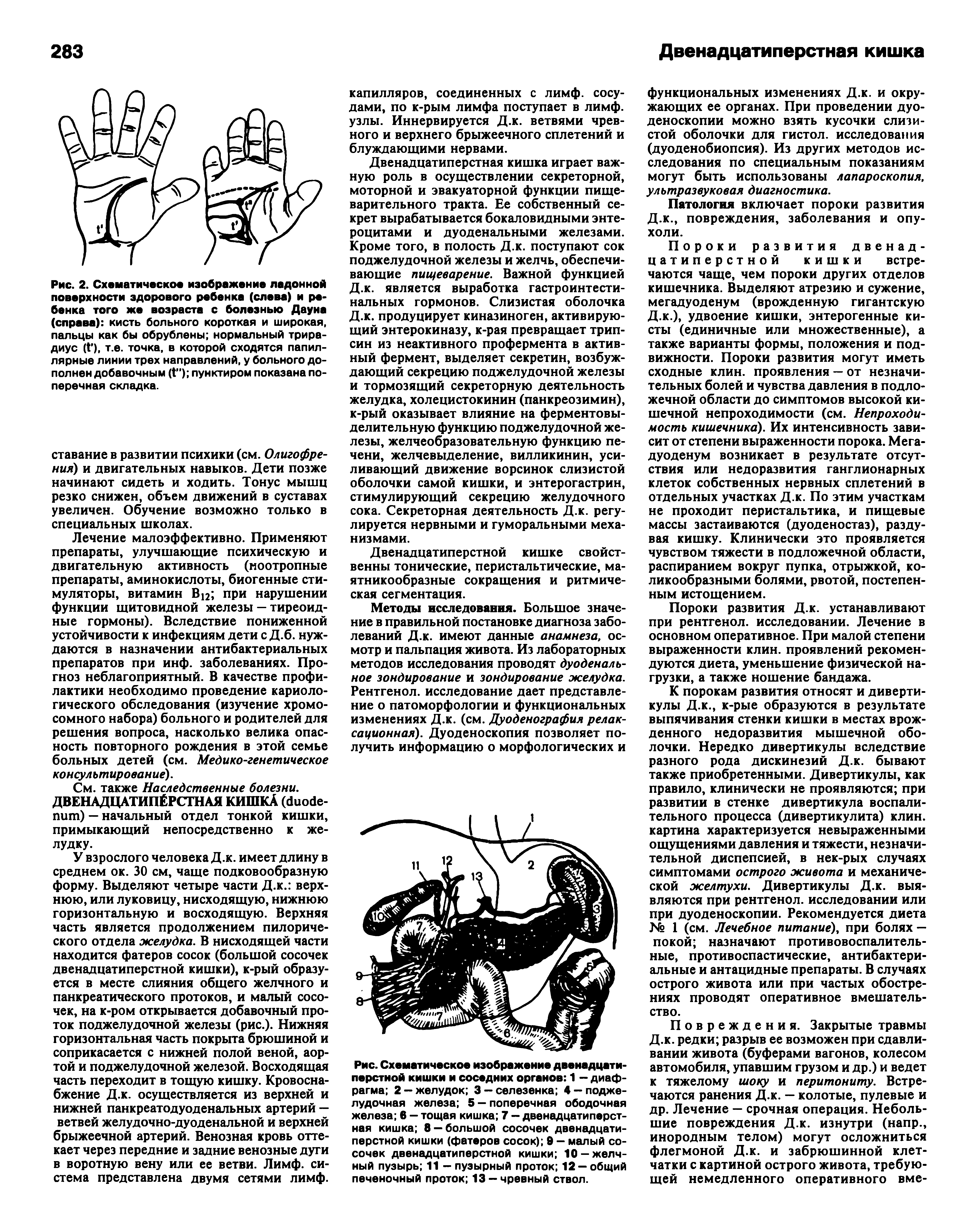 Рис. Схематическое изображение двенадцатиперстной кишки и соседних органов 1 - диафрагма 2 — желудок 3 — селезенка 4 — поджелудочная железа 5 — поперечная ободочная железа в - тощая кишка 7 - двенадцатиперстная кишка 8 —большой сосочек двенадцатиперстной кишки (фатеров сосок) 9 - малый сосочек двенадцатиперстной кишки 10-желчный пузырь 11 - пузырный проток 12 —общий печеночный проток 13 —чревный ствол.