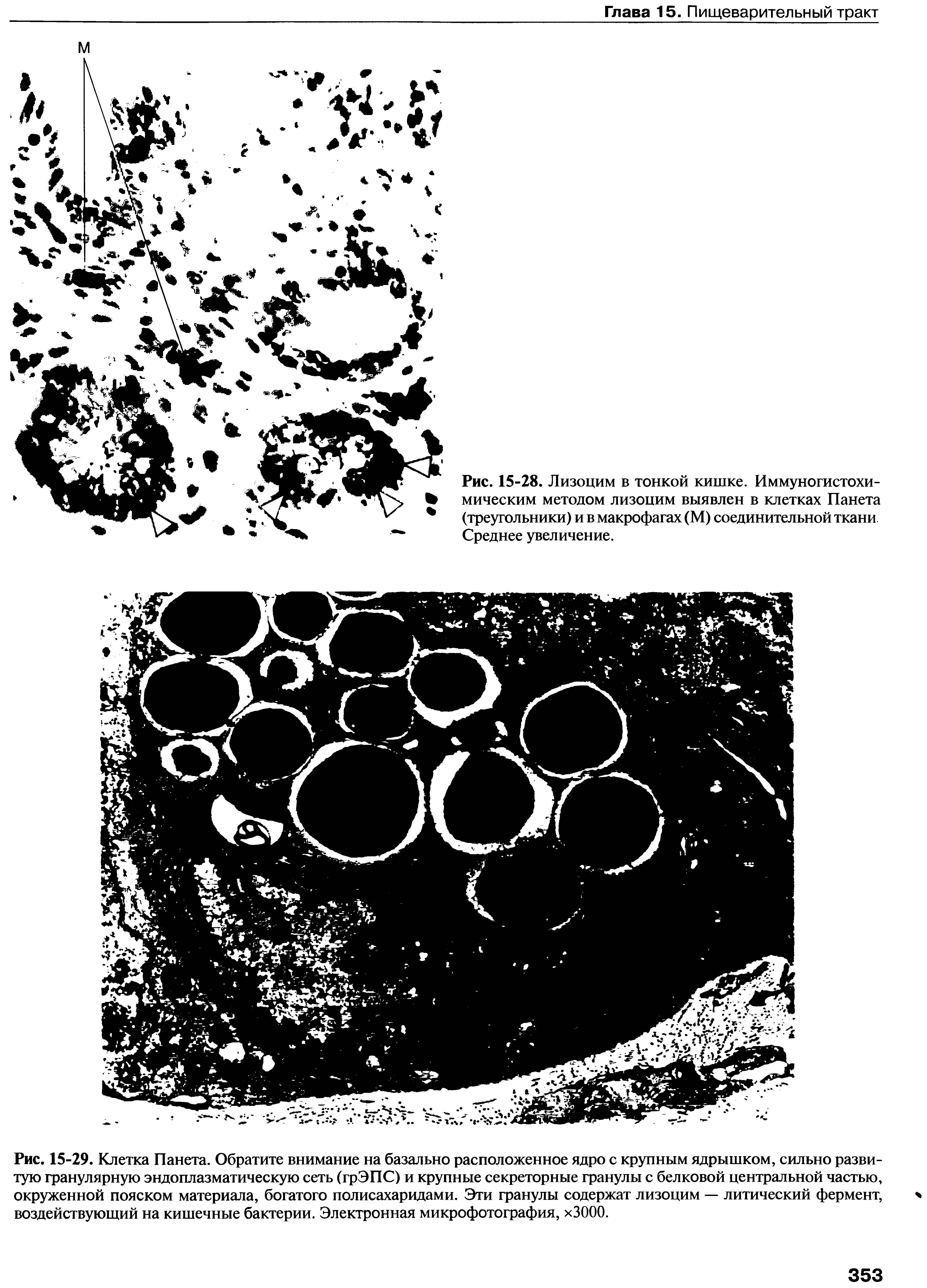 Рис. 15-28. Лизоцим в тонкой кишке. Иммуногистохимическим методом лизоцим выявлен в клетках Панета (треугольники) и в макрофагах (М) соединительной ткани Среднее увеличение.